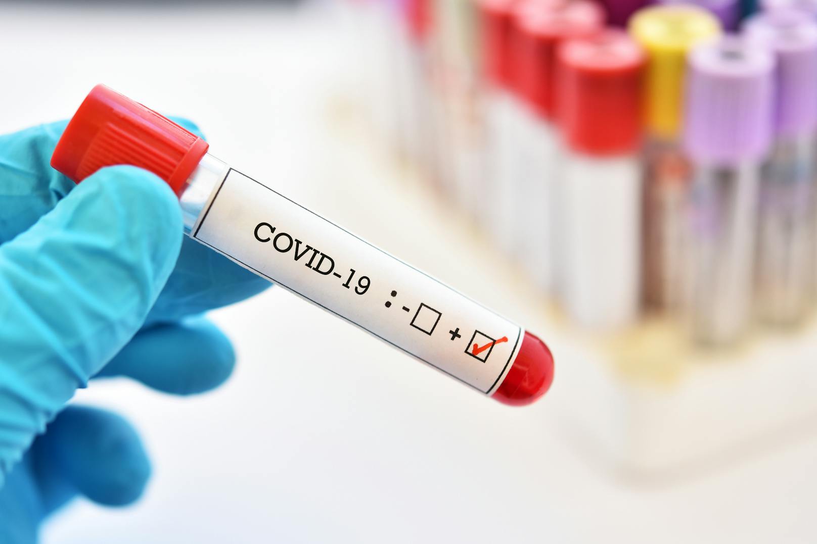 Testen: Wenn du Symptome verspürst oder Kontakt zu einem mit dem Coronavirus infizierten Menschen hattest, kannst du zur Sicherheit einen Test machen. 