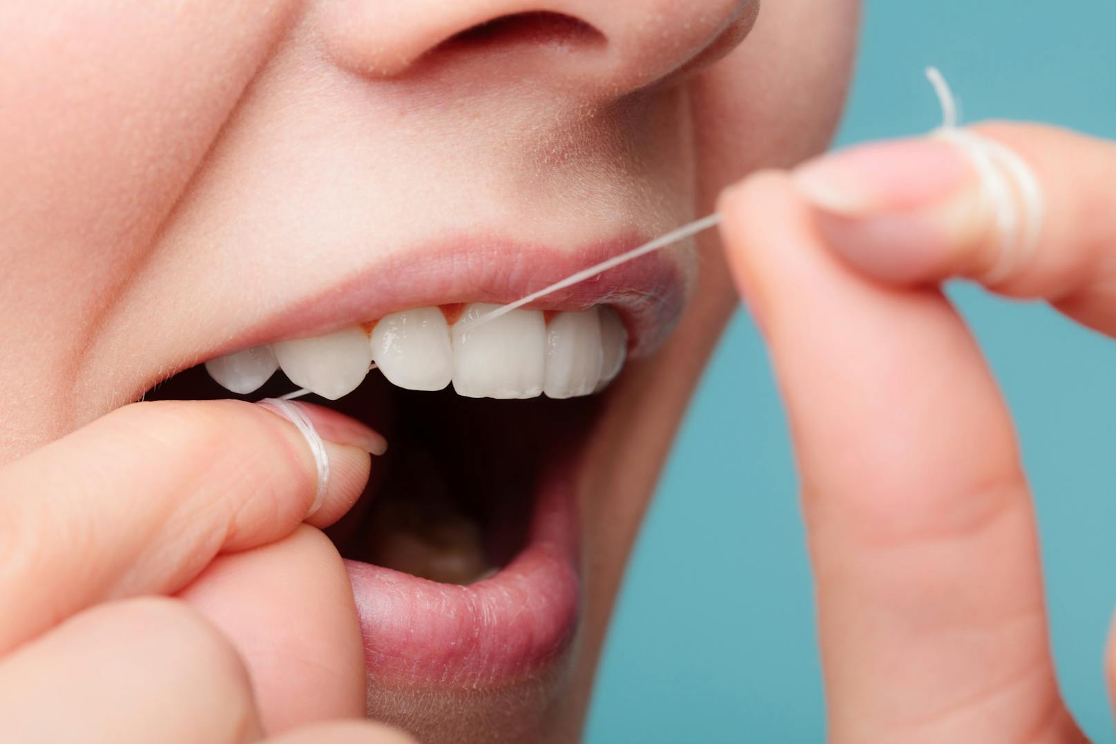 <strong>Keine Zahnseide verwenden:</strong> Zahnseide ist genauso wichtig wie eine Zahnbürste. Mit Schrubben erreicht man die Zahnzwischenräume nicht. Hier müssen Zahnseide oder Interdentalbürsten her. <br>