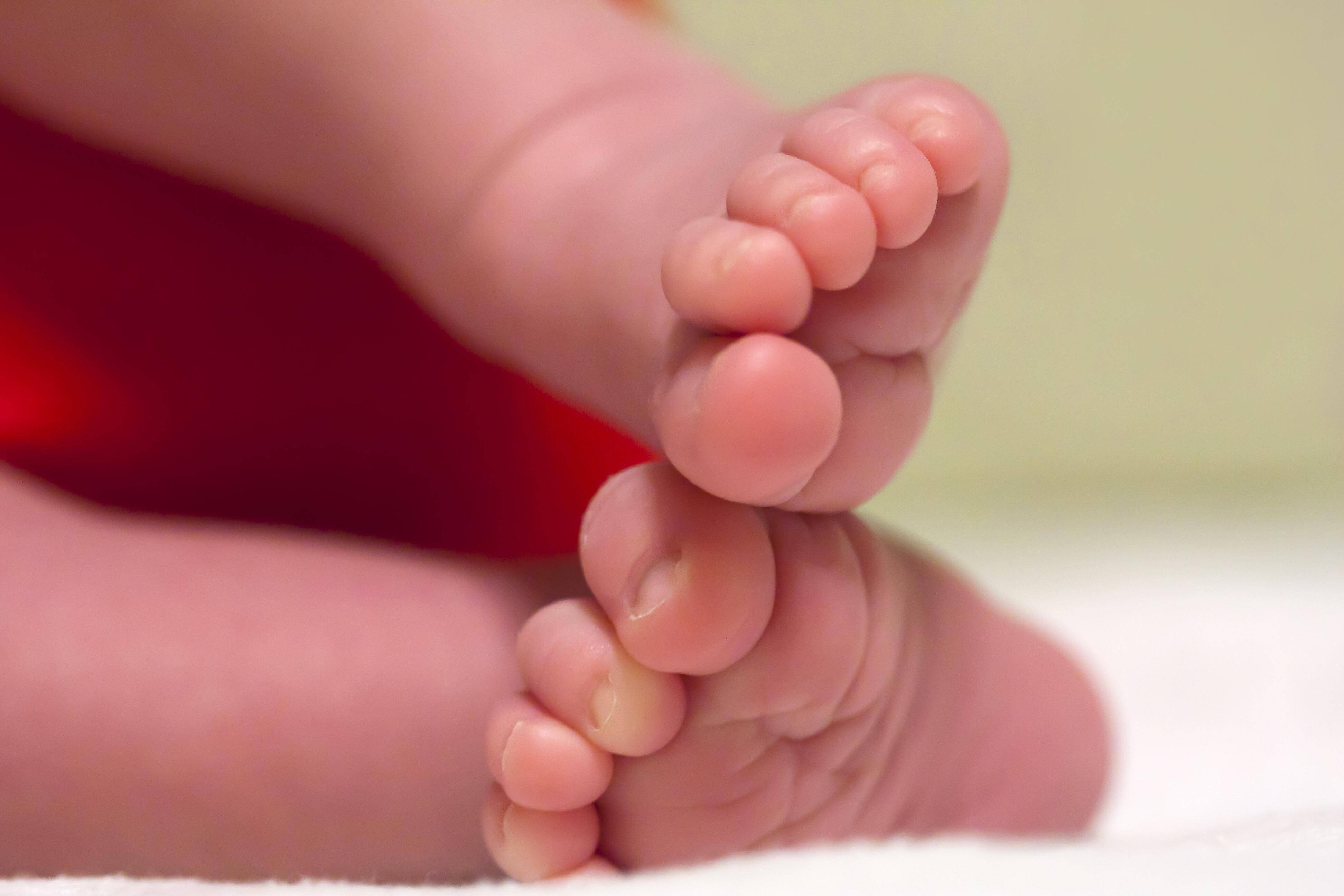 Bei der Geburt am Freitagmorgen wurde der Kopf des Neugeborenen vom Körper getrennt.