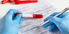 Gefährliche Panne: PCR-Test mehr als 72 Stunden gültig?