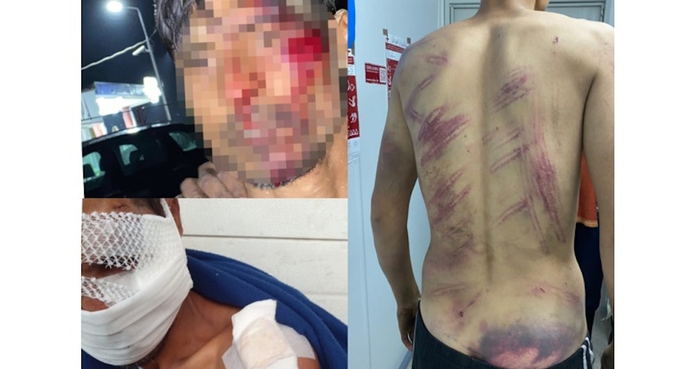 Mit größter Brutalität soll die kroatische Grenzpolizei bei den Push-Backs der Flüchtlinge vorgehen.