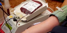 Grüne gegen Antrag für gleiches Recht bei Blutspenden