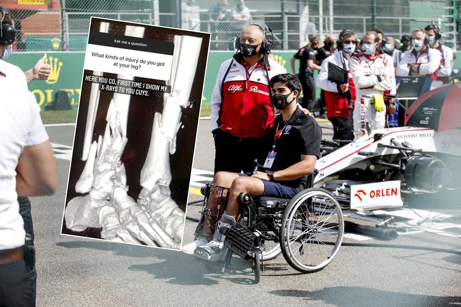 Juan Manuel Correa zeigt sein zertrümmertes Bein