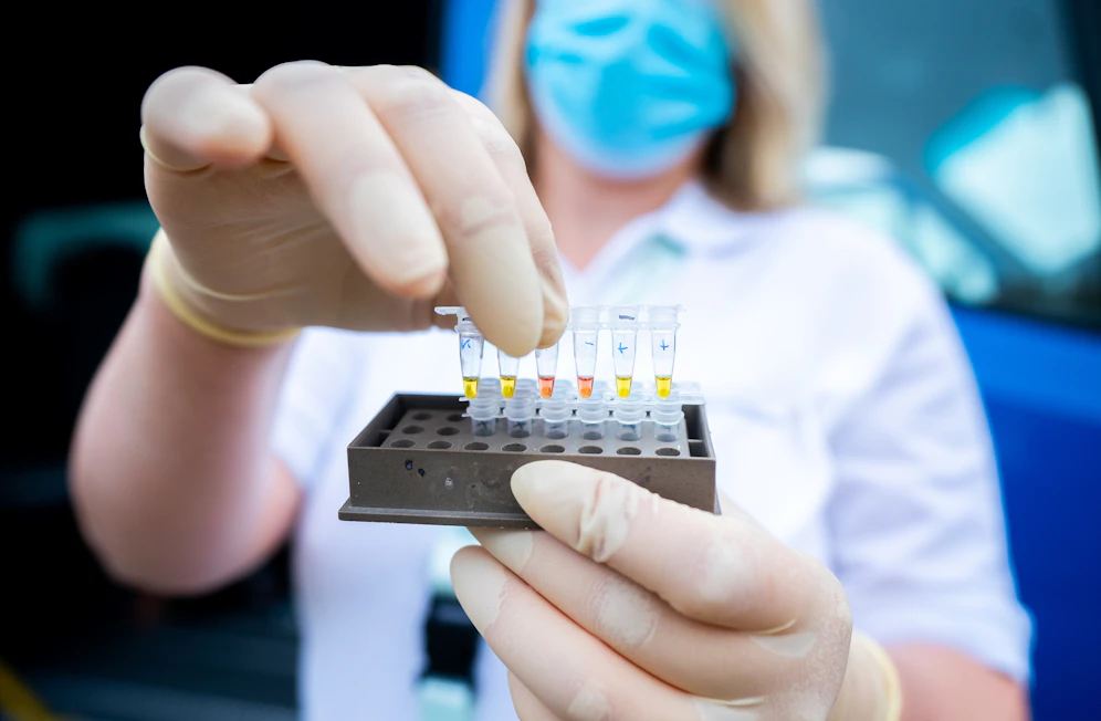 Eine Frau hält negativ und positiv getestete Proben für das Analyse-Gerät im 