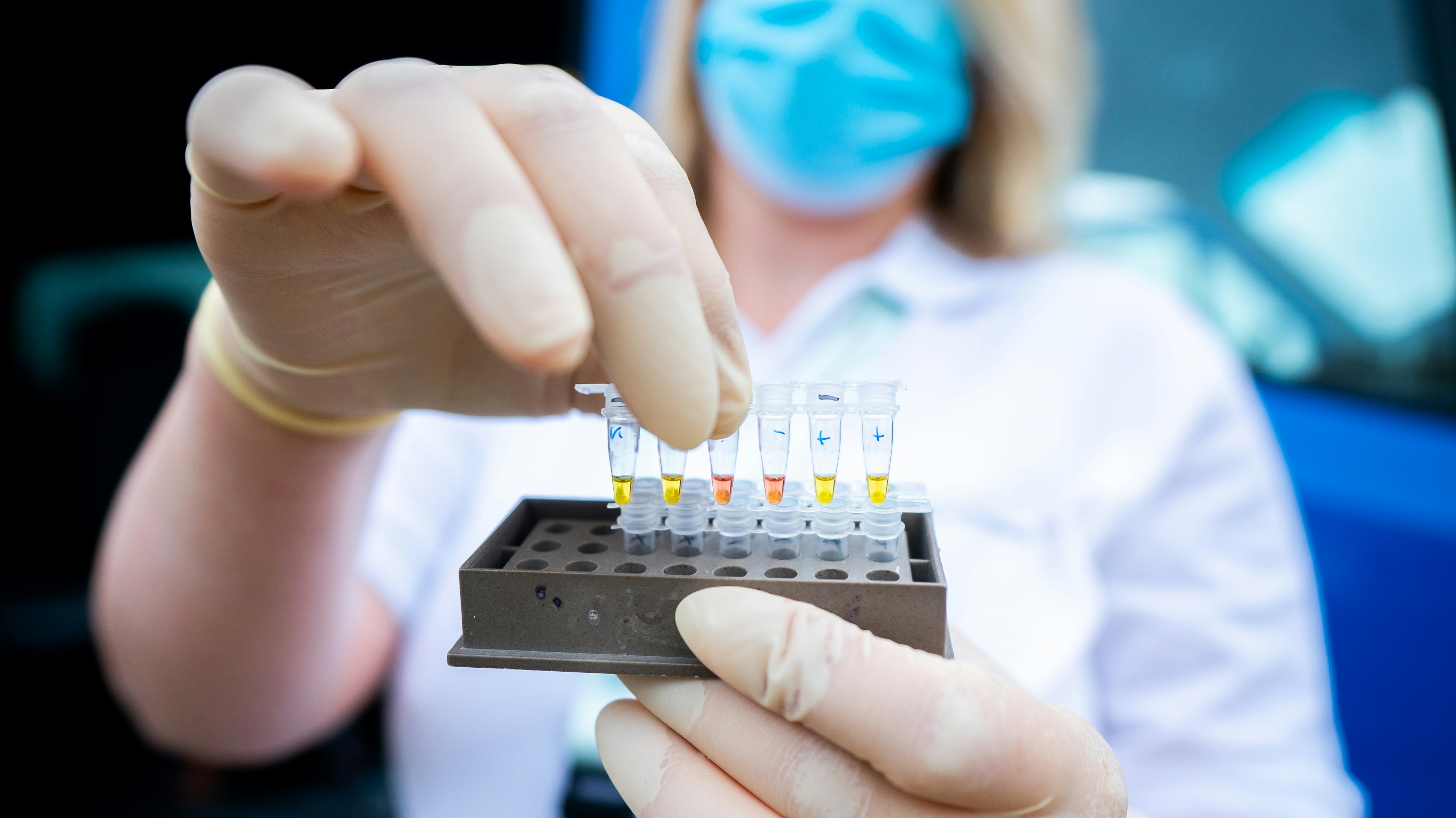 Eine Frau hält negativ und positiv getestete Proben für das Analyse-Gerät im "Cluster-Buster-Bus" in Wien