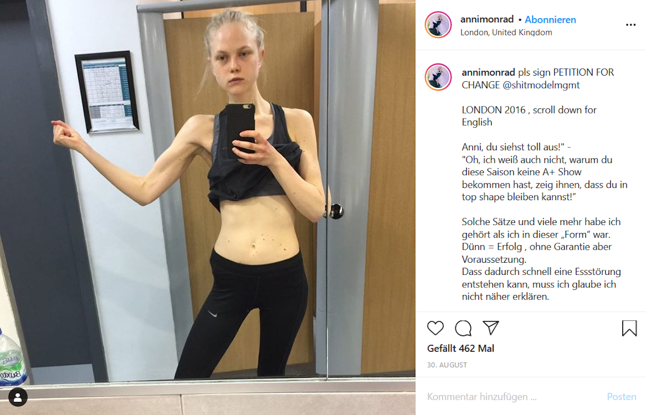 Heute.at - Model sollte gegen Hunger Drogen nehmen