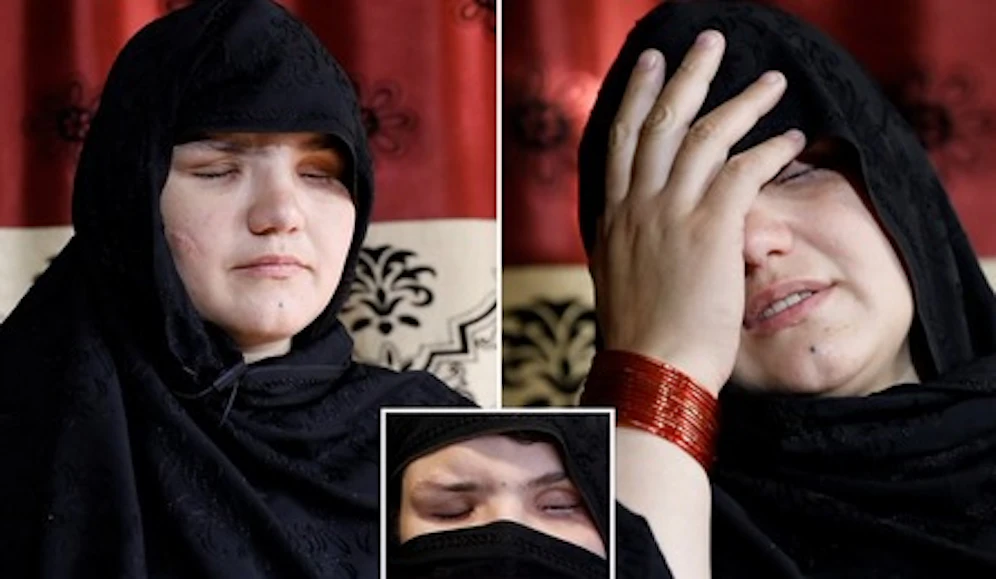 Einer Polizistin in Afghanistan wurden die Augen ausgestochen - vermutlich von Taliban.