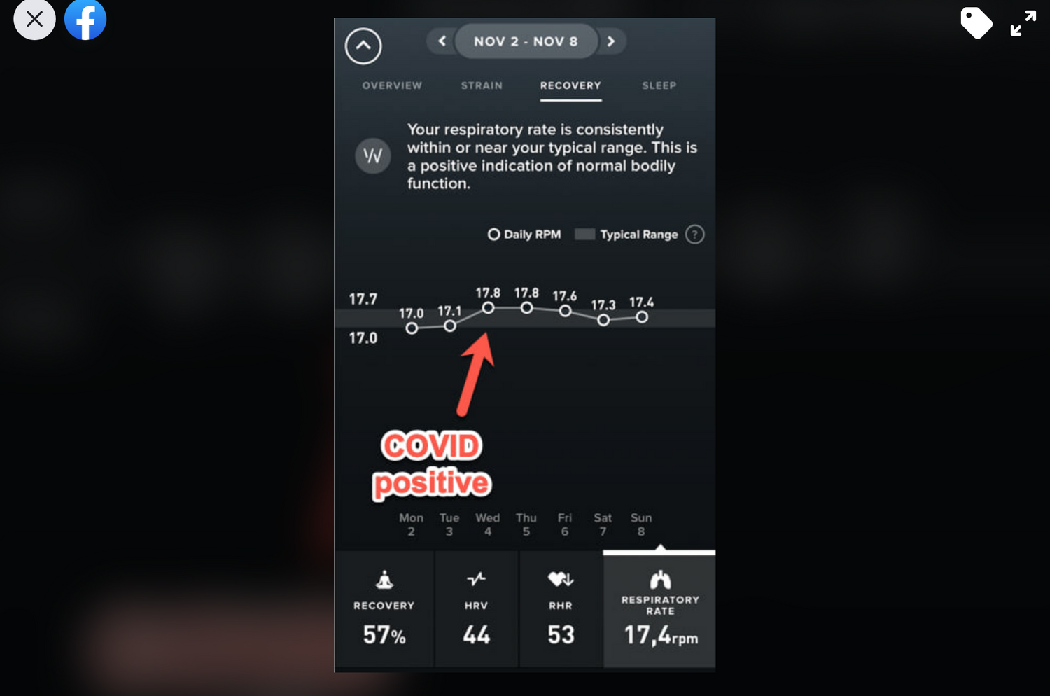 Die Atemfrequenz war deutlich erhöht bei Gschwandtner.