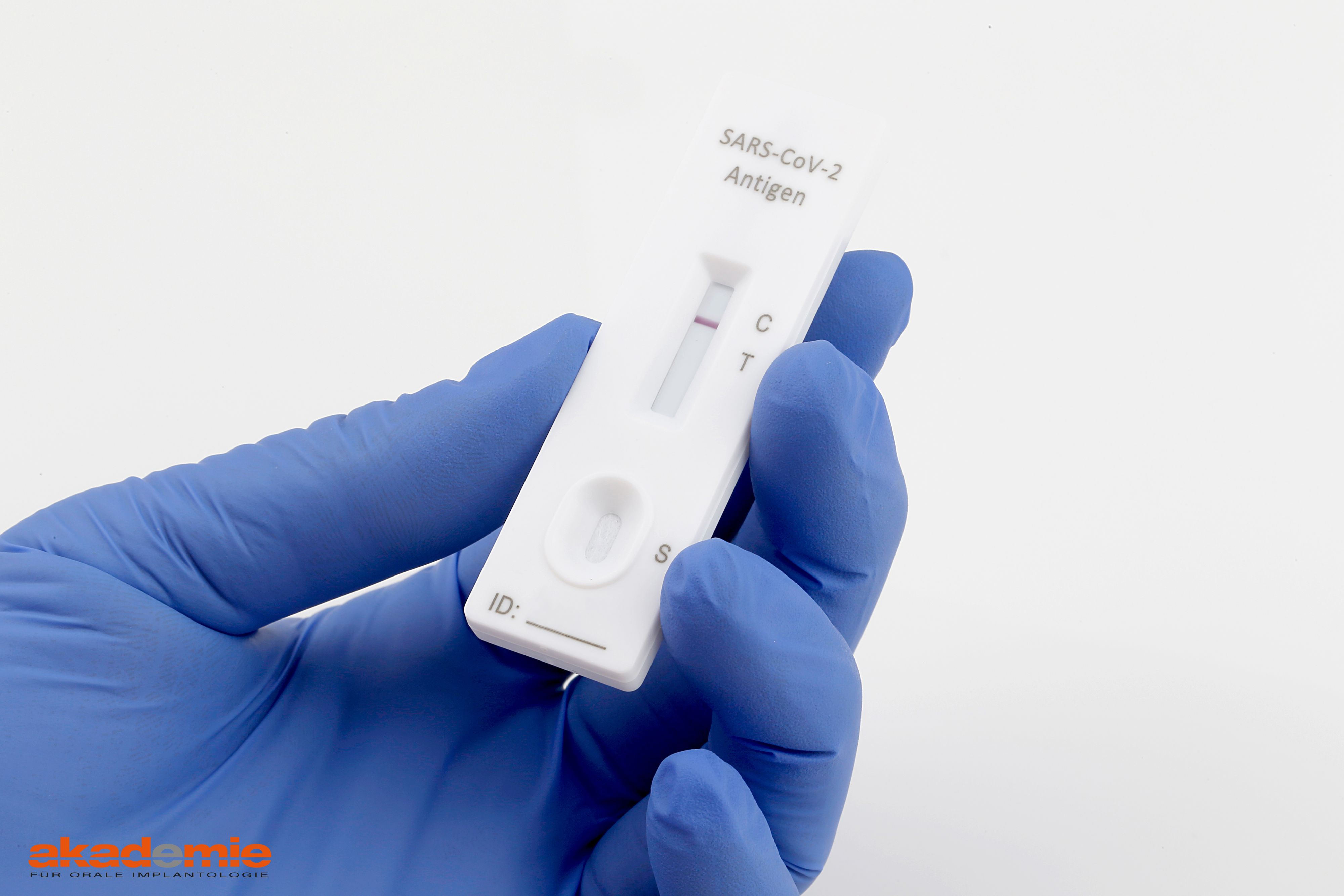 Das Ergebnis des Antigen-Schnelltests liegt bereits nach 10 bis 15 Minuten vor.