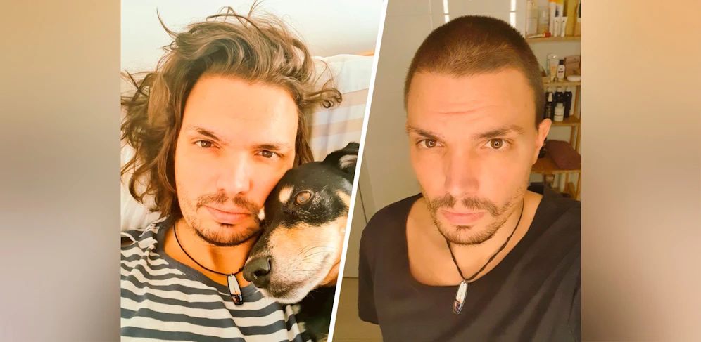 Christoph Träumer gingen nach Corona die Haare aus – er ließ sie nun abschneiden.
