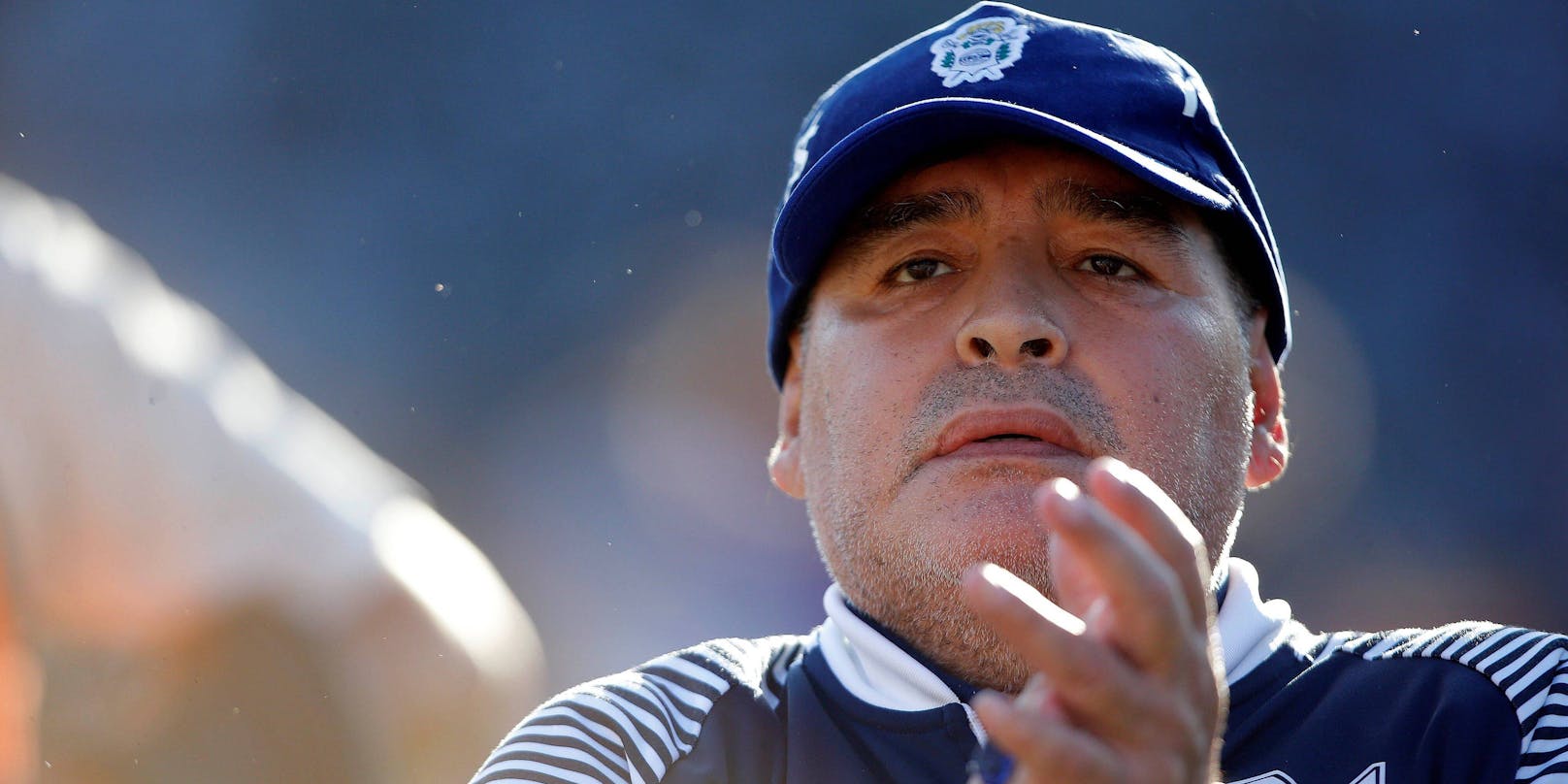 Diego Maradona muss operiert werden. 