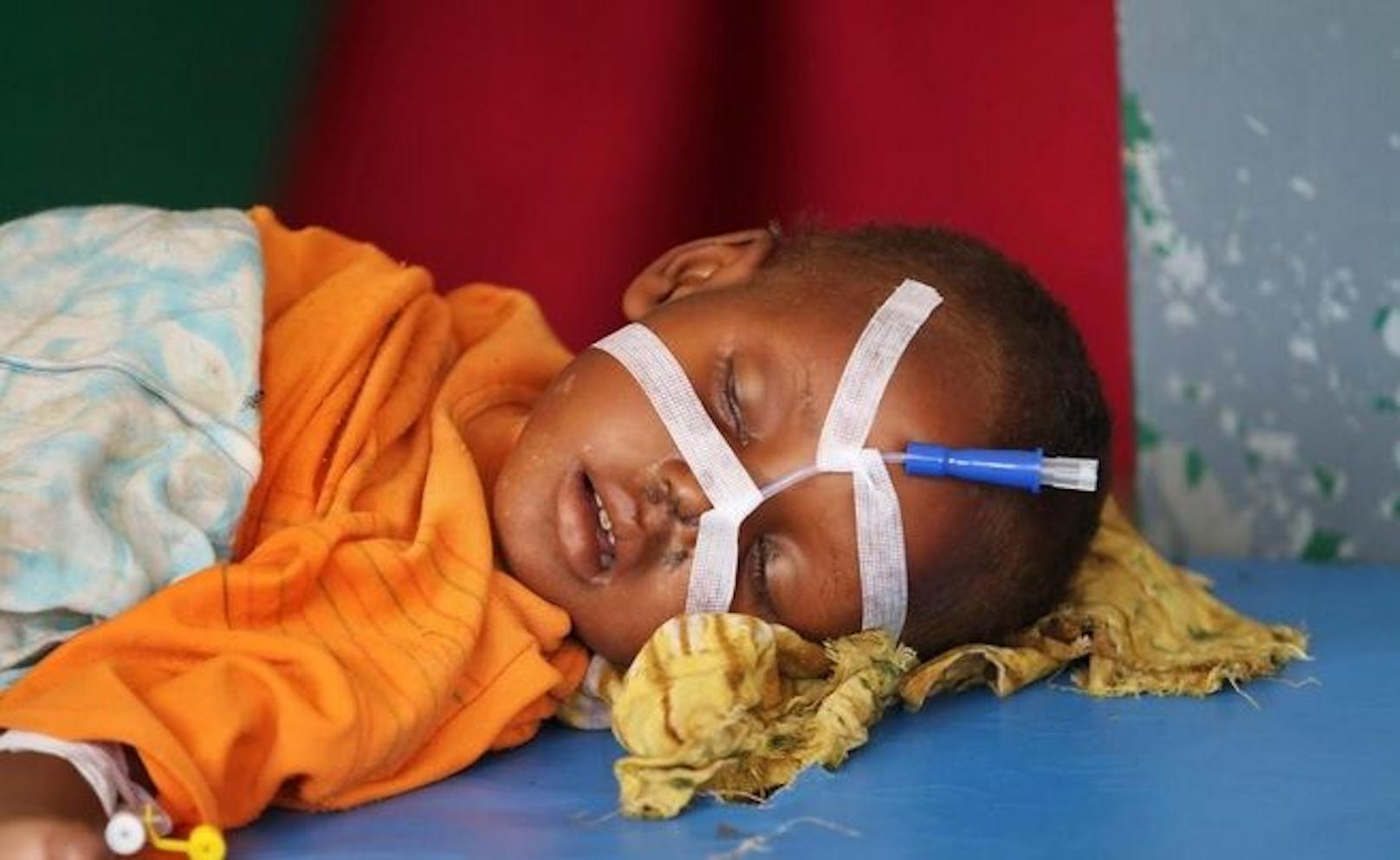 Save the Children fordert, globale Konflikte zu beenden: Ein Kind in einem Spital in Somalia. 