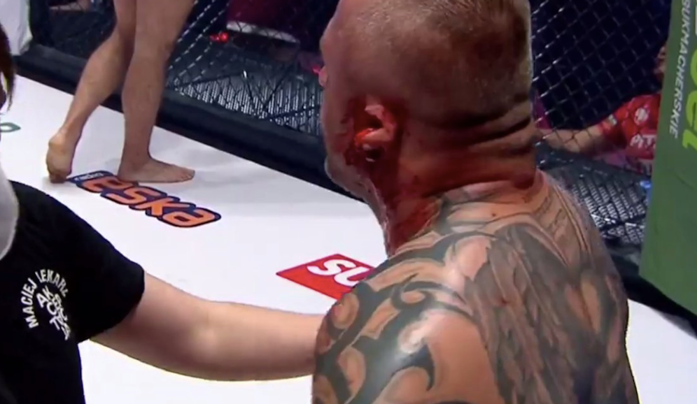 Lukasz Borowski blutet stark. Sein Ohr ist eingerissen.