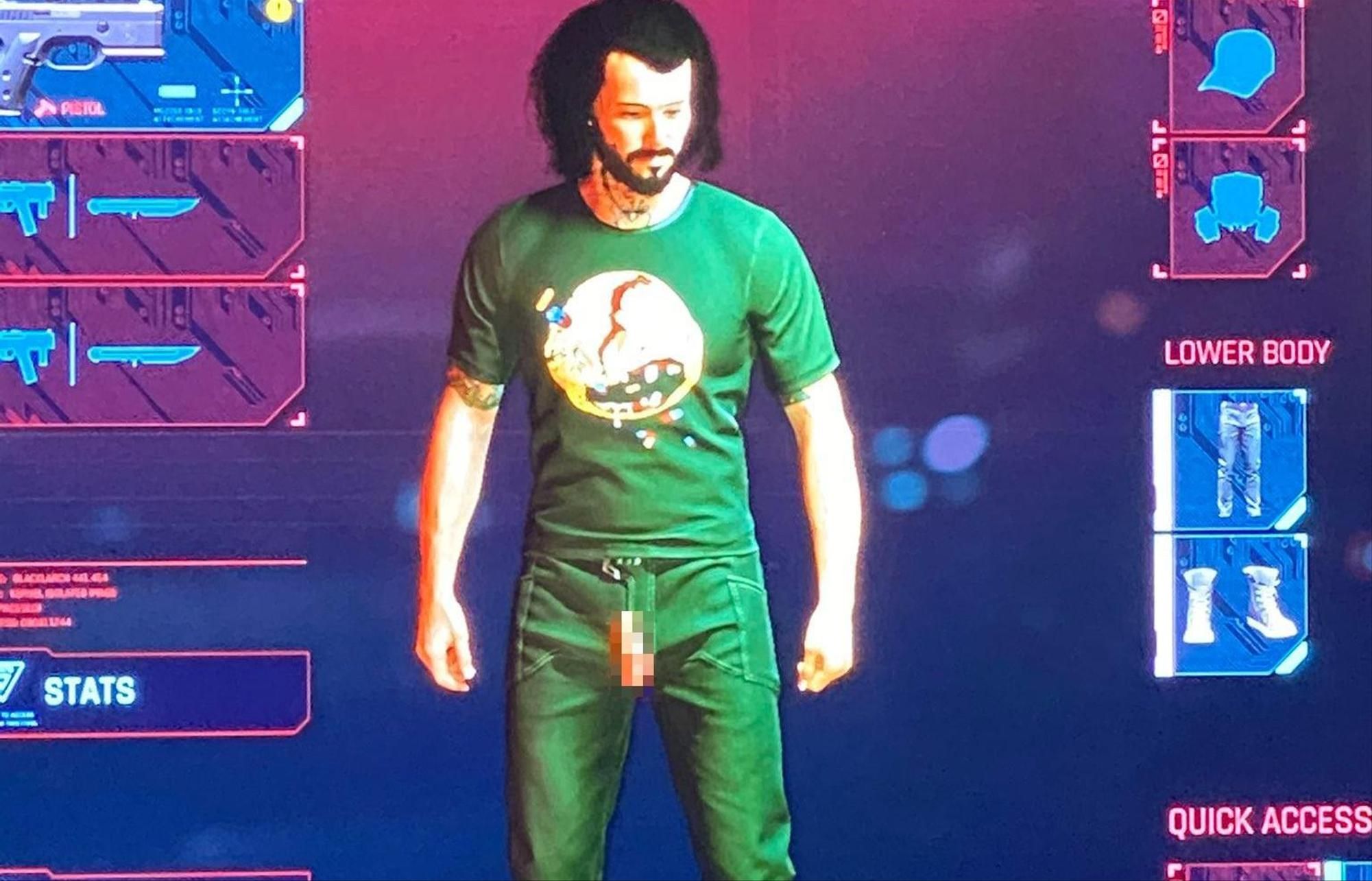 So sieht der Penis-Bug in "Cyberpunk 2077" aus.