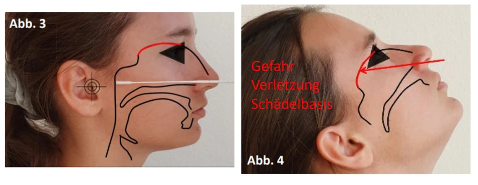 Auf der linken Abbildung ist zu sehen, was die richtige Kopfhaltung ist.