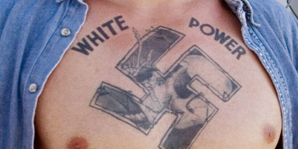 Der Patient hatte am ganzen Körper Nazi-Tattoos.