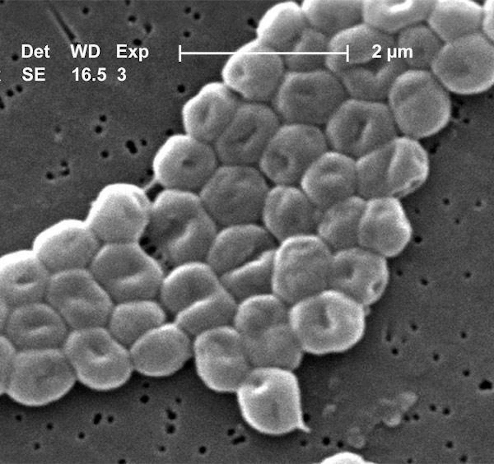 Acinetobacter baumannii, Priorität 1: Acinetobacter werden von der WHO als einer der gefährlichsten Bakterienstämme eingestuft.