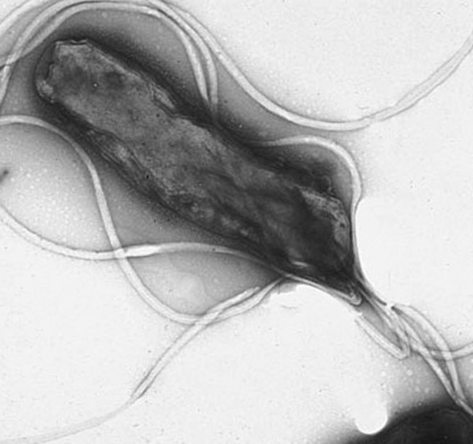 Helicobacter pylori, Priorität 2: Helicobacter werden für eine Reihe von Magenerkrankungen verantwortlich gemacht.