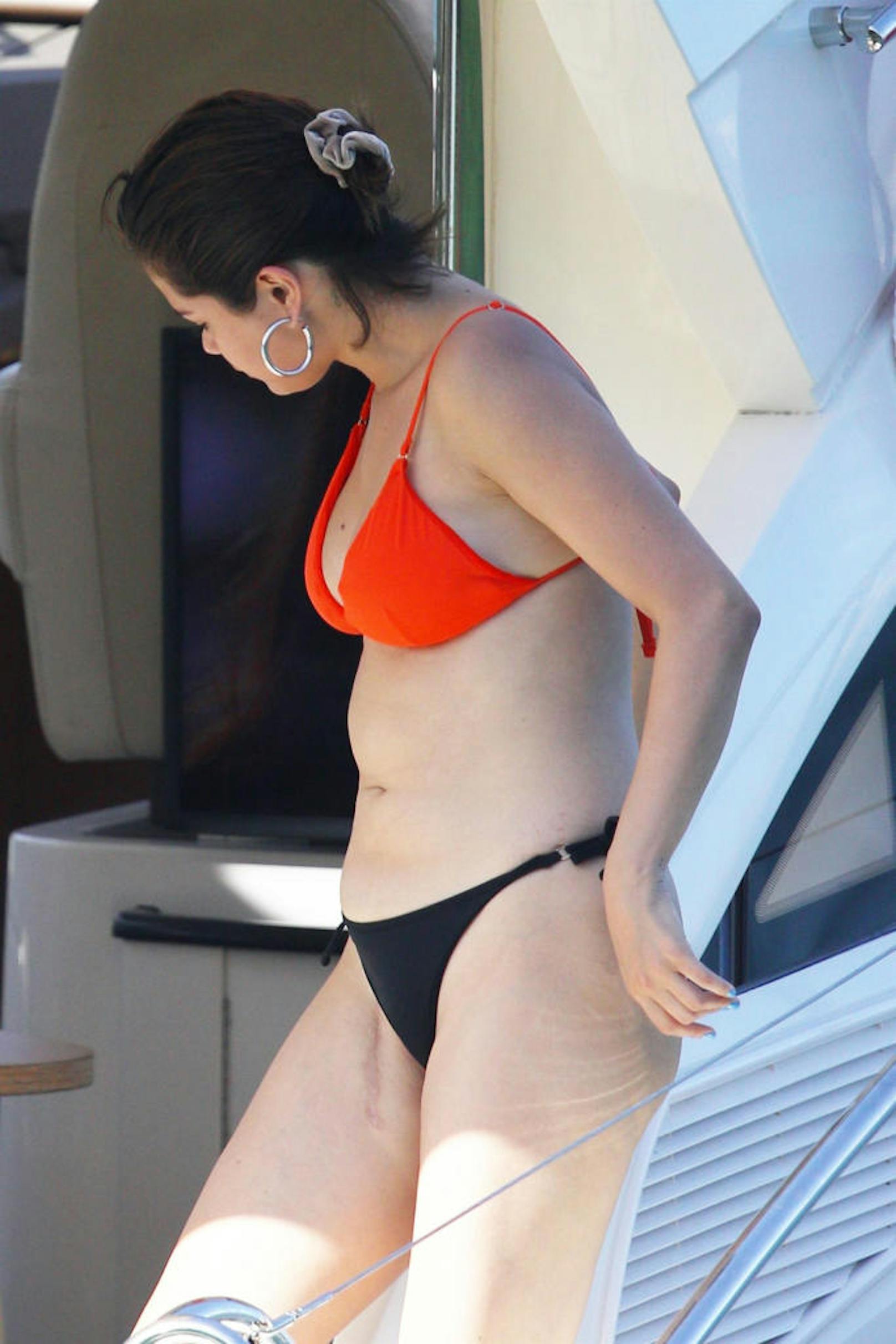 Selena Gomez steht zu ihrem Körper. Sie hat keine Hemmungen, ihre OP-Narbe herzuzeigen.