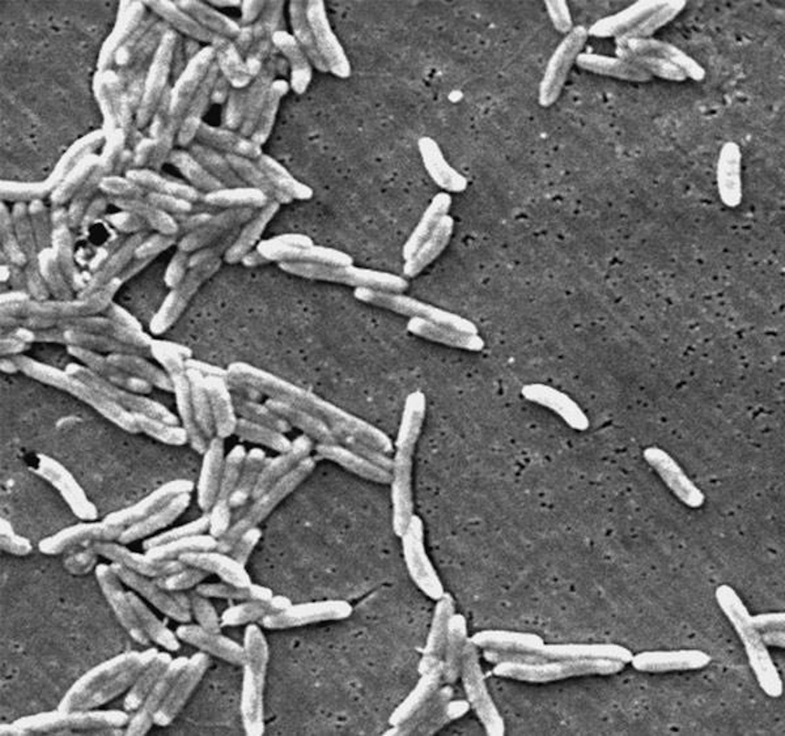 Campylobacter spp., Priorität 2: Erreger dieser Gattung können Zoonose und Durchfallerkrankungen hervorrufen.