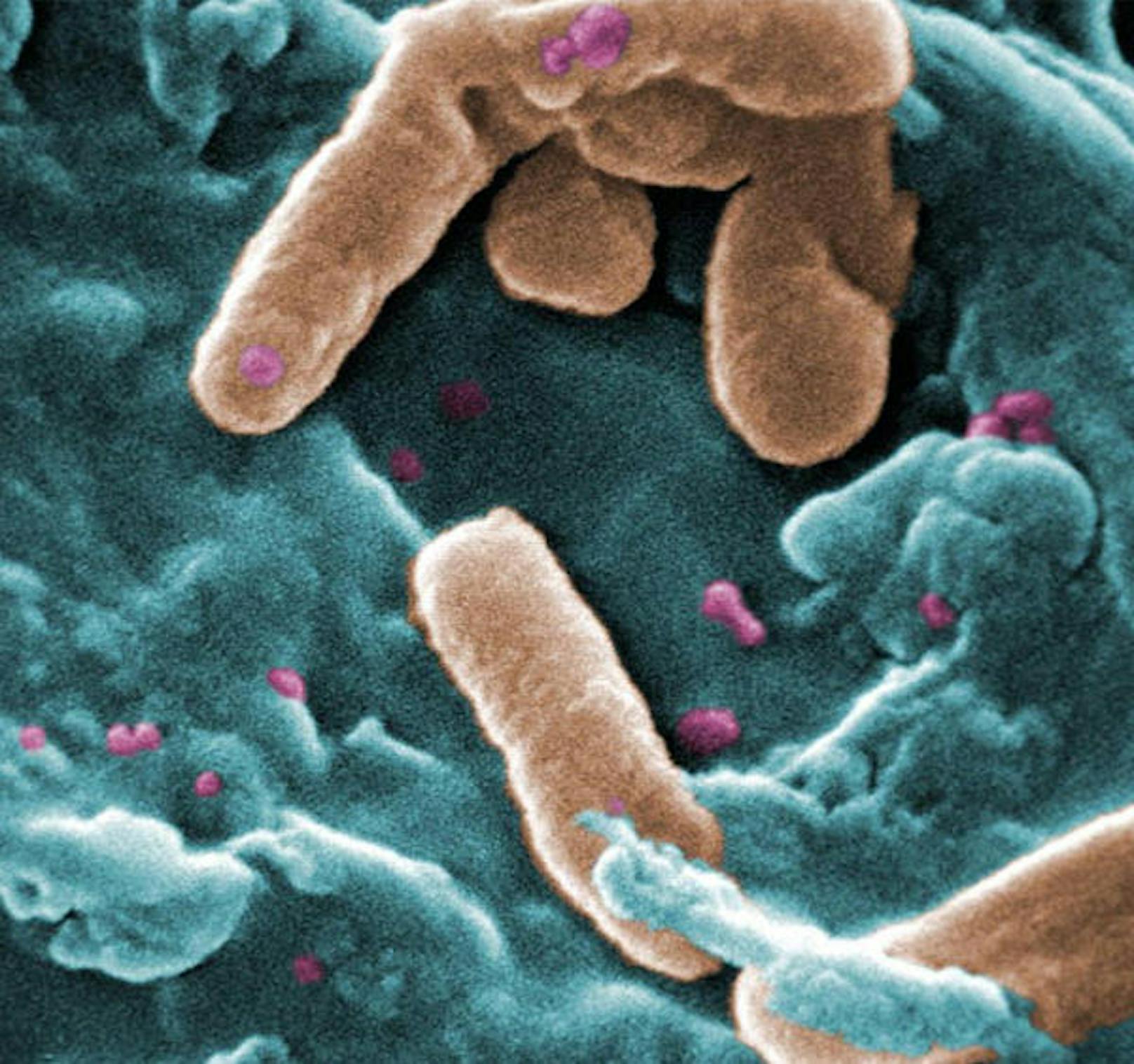 Pseudomonas aeruginosa, Priorität 1: Auch für diese Bakterien gilt es schnellstens neue Antibiotika zu finden.