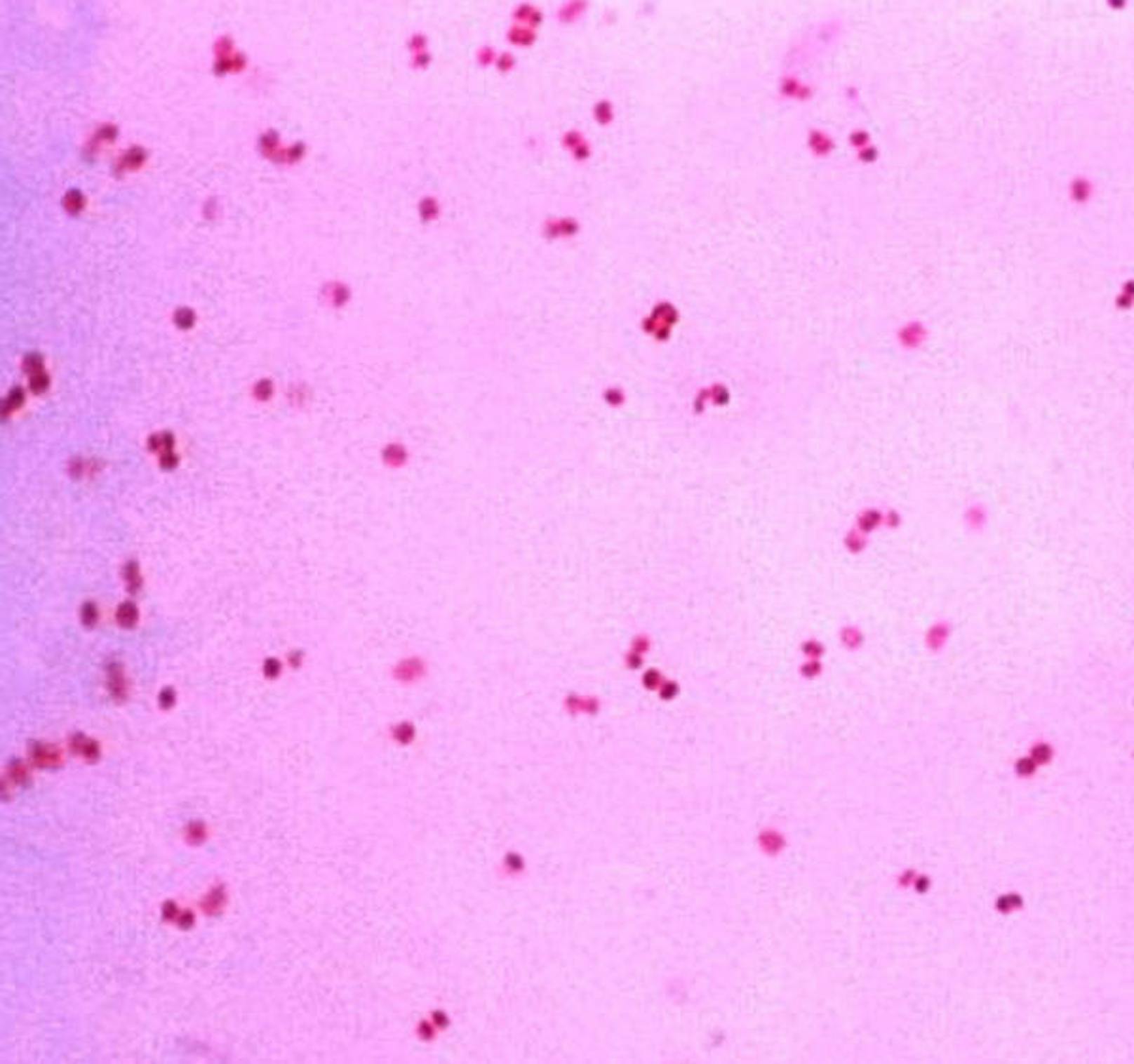 Neisseria gonorrhoeae, Priorität 2: Gonokokken sind Auslöser von Tripper.