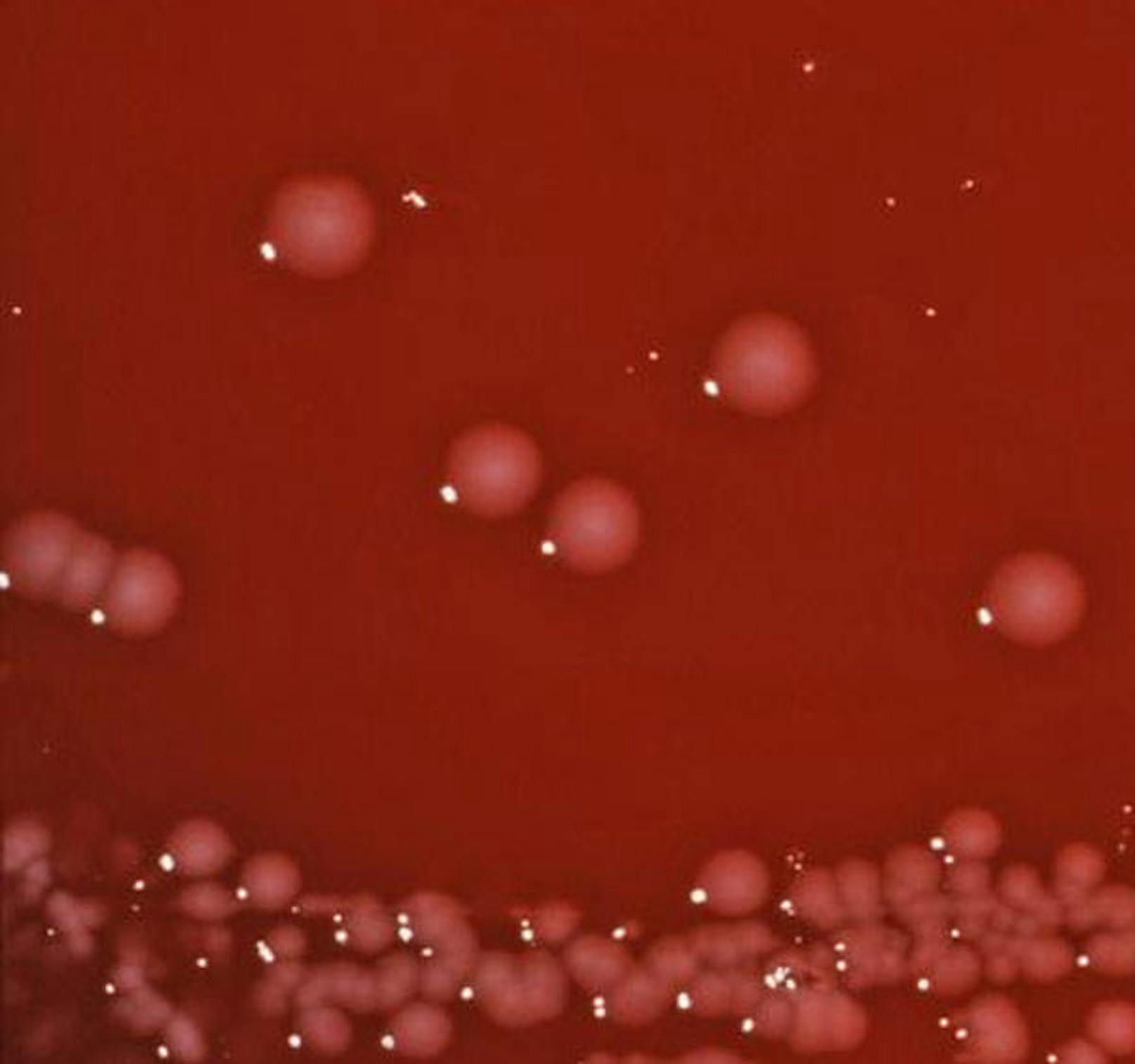 Shigella spp., Priorität 3: Shigella infizieren jährlich rund 160 Mio. Menschen.