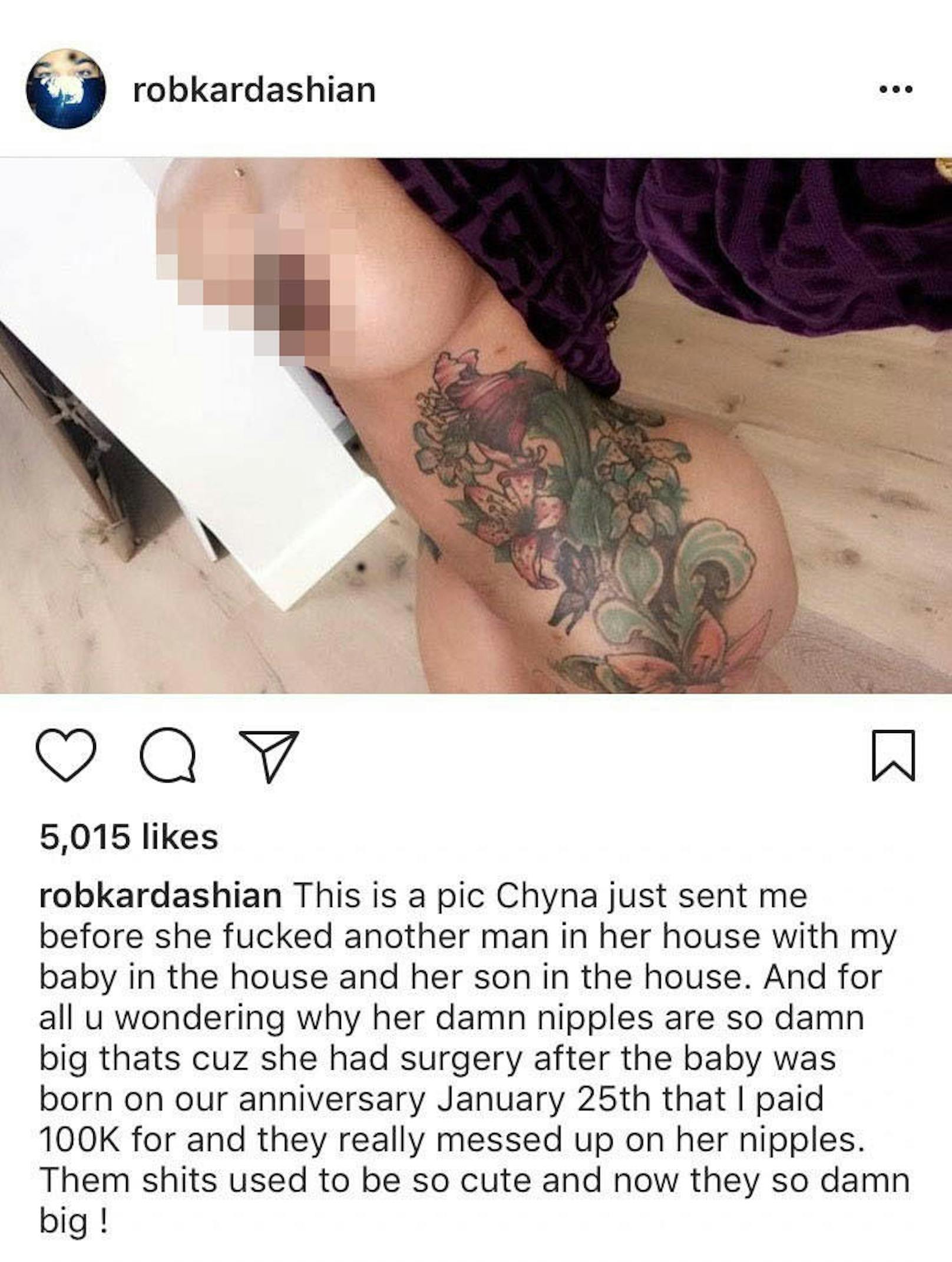 Rob Kardashian postet dieses Nacktfoto von Black Chyna