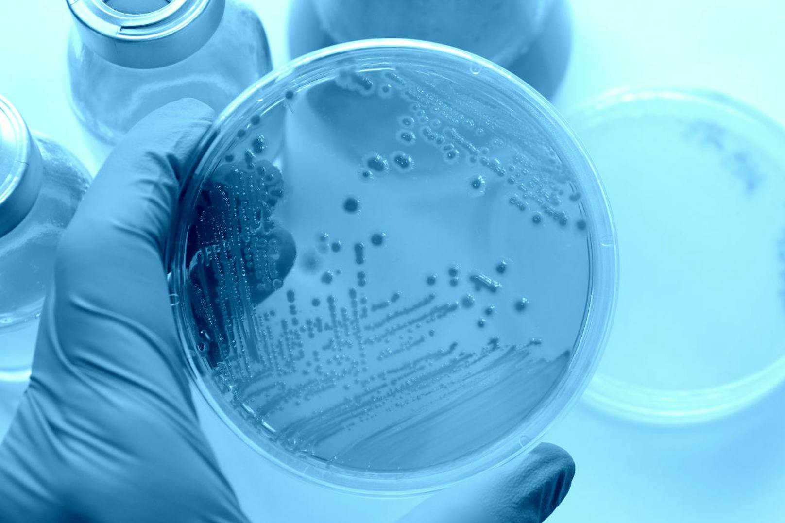 Multiresistente Keime können zu einem bakteriellen Widersacher für den Menschen werden.&nbsp;