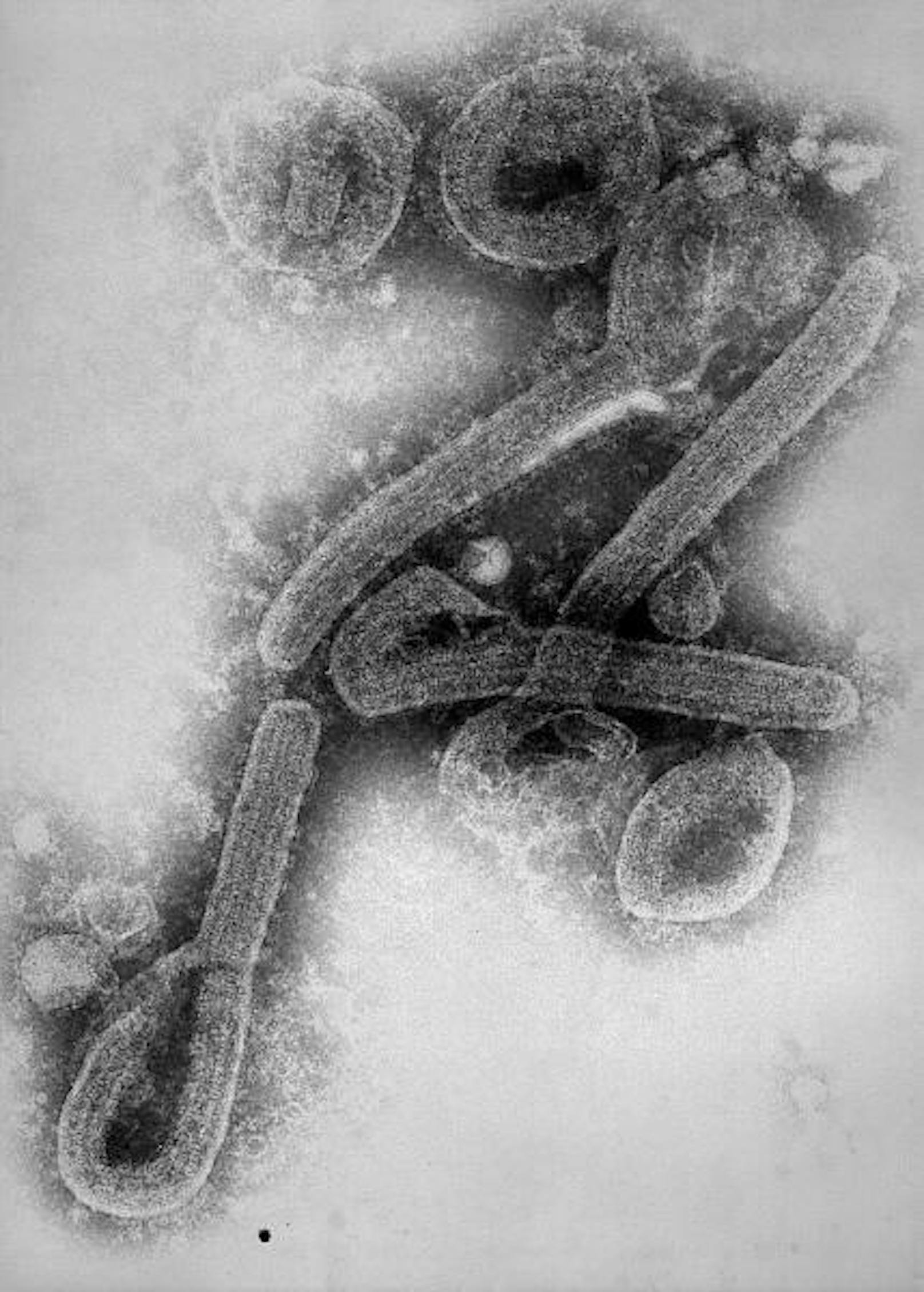 Und so war bald klar: Statt mit einer Influenza hatte man es mit einem deutlich gefährlicheren und unbekannten Virus zu tun, das später nach dem Ort des Ausbruchs als Marburg-Virus in die Bücher einging.