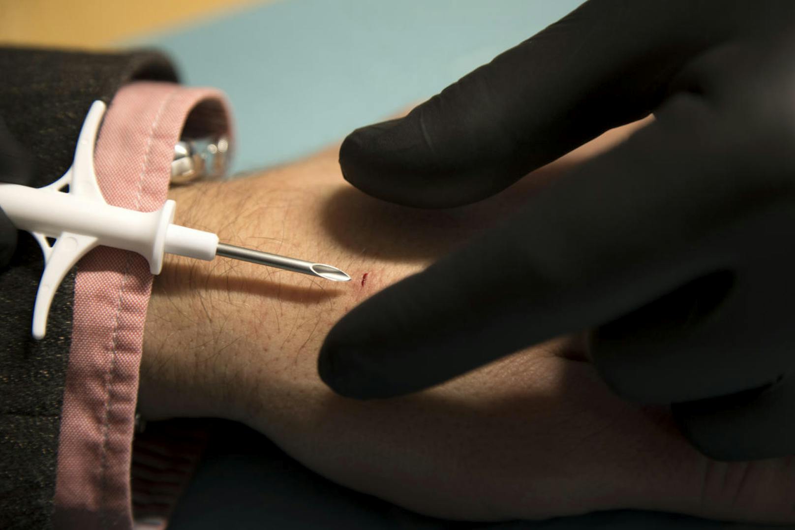 Geschätzte 2.000 Personen in Schweden haben sich solche biometrische Chips unter die Haut implantieren lassen.