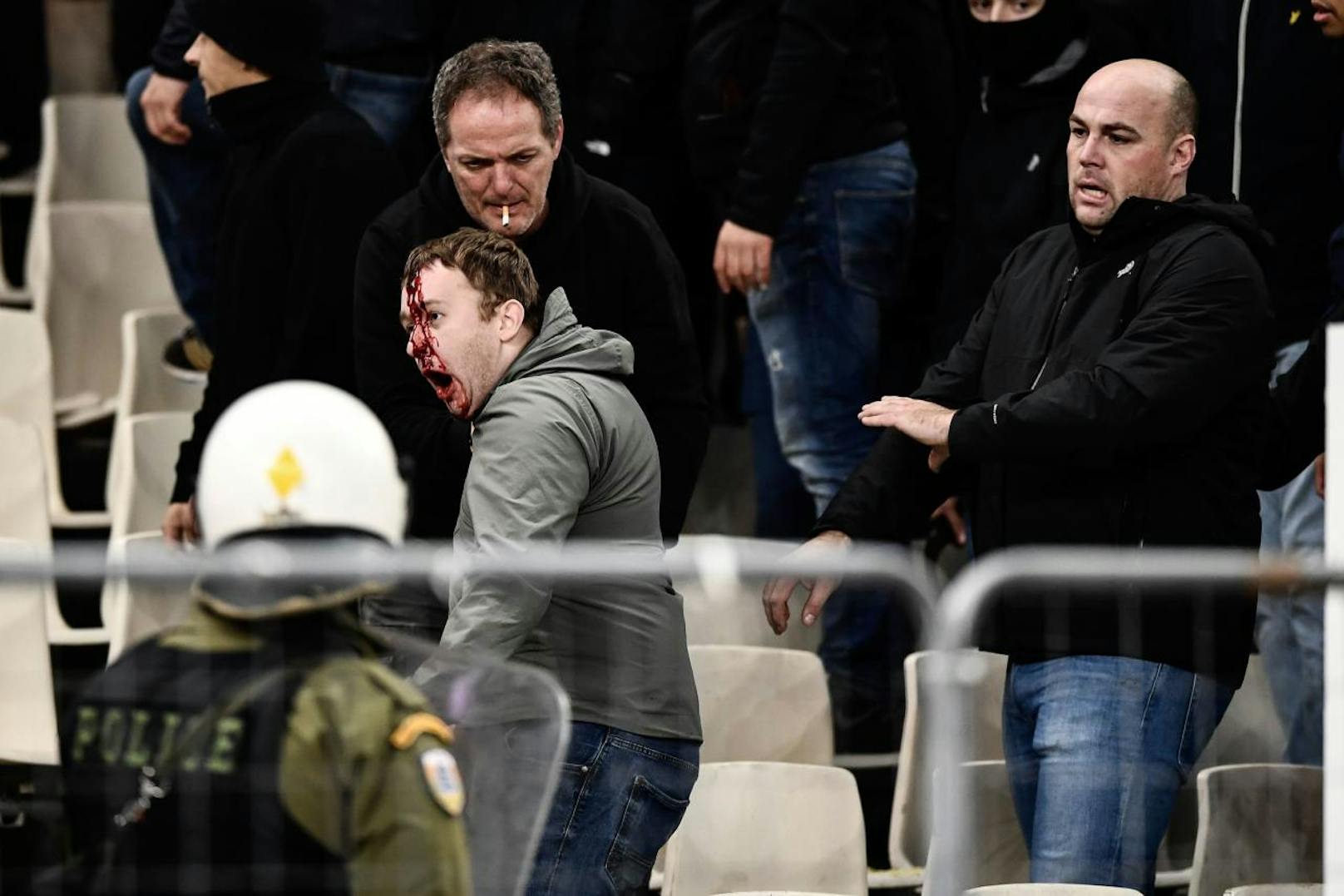 Ajax-Fans sind nach dem Hooligan-Angriff blutüberströmt.
