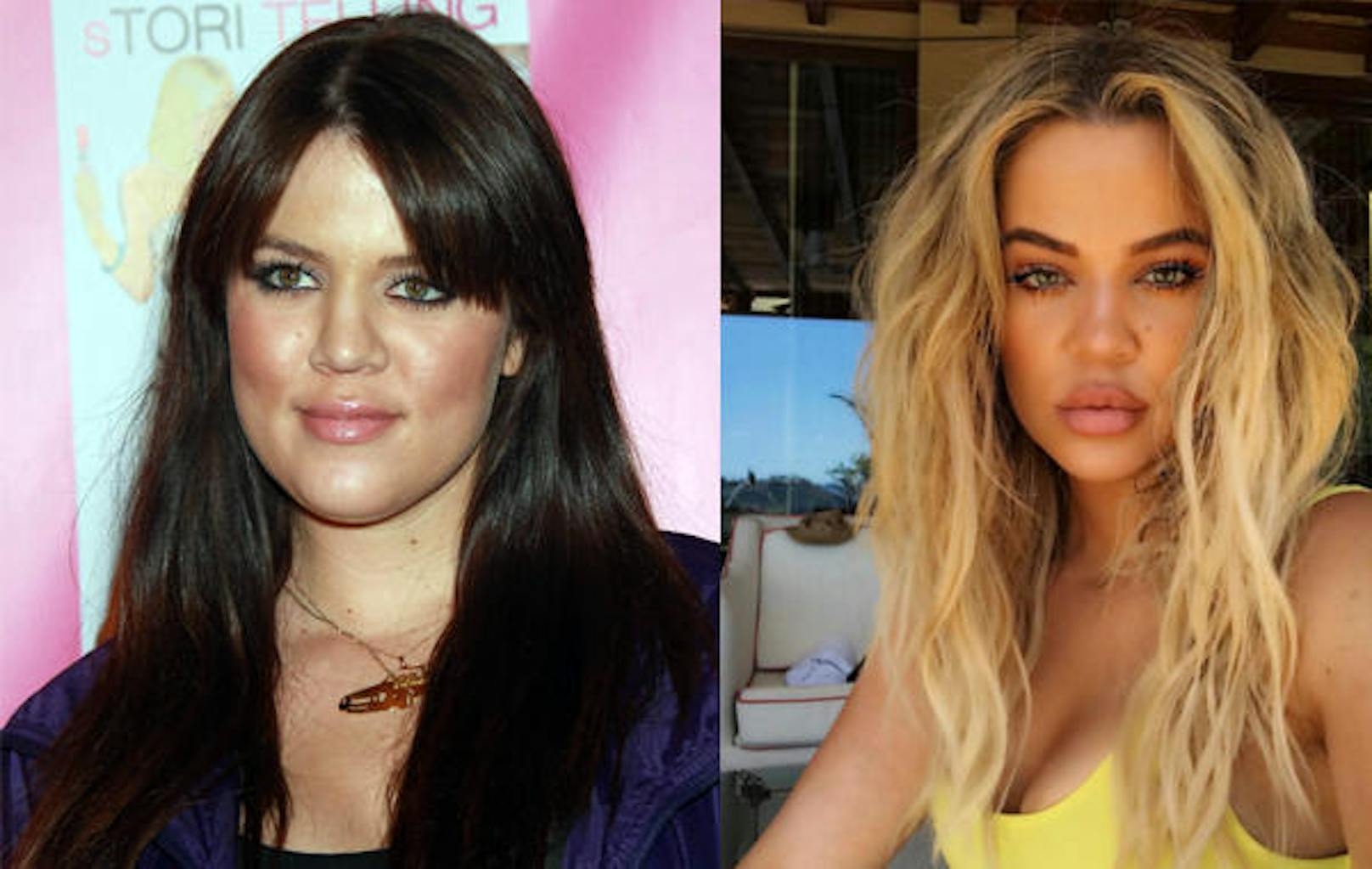 Khloé Kardashian vorher und nachher: Aussehen ist nur eine Frage des Geldes