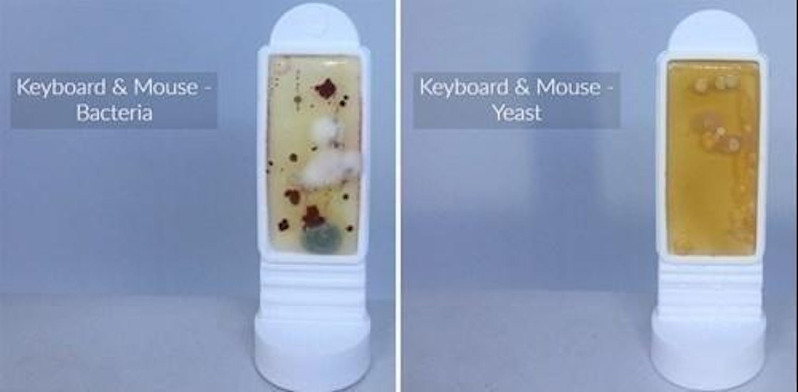 Zum Vergleich: der Bakterien-Abstrich (l.) und der Hefepilz-Abstrich von Keyboard und Maus eines PCs