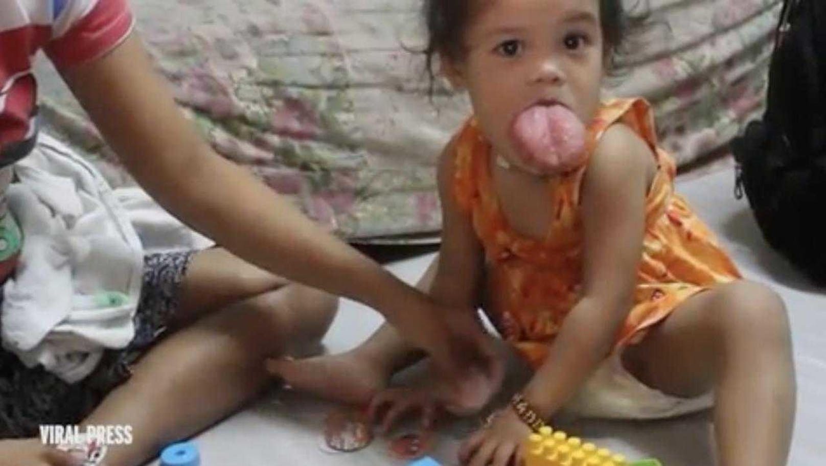 Die Eltern von Zhyrille Cruz sind verzweifelt. Die Familie lebt unter ärmlichen Bedingungen in Manila auf den Philippinen mit einem Monatseinkommen von umgerechnet nicht ganz 130 Euro im Monat.