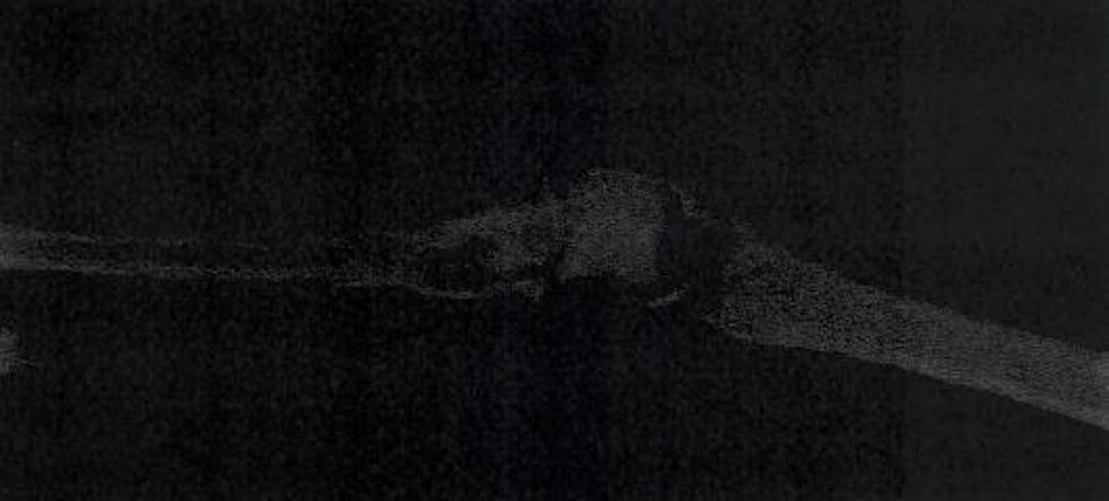 Röntgenaufnahme des Ellbogens am 29.5.2013.