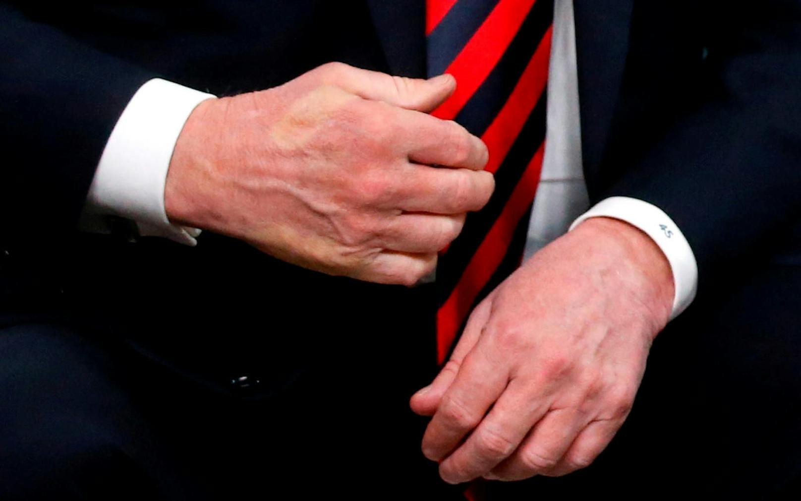 Es ist nicht das erste Mal, dass sich die beiden ein "Handshake Battle" liefern. Beim G-7-Gipfel in Kanada im vergangenen Jahr, drückte Macron Trumps Hand so fest,<a href="https://www.heute.at/welt/news/story/Rache-fuer-Paris--Macron--quetscht--Trump-Hand-44377536" target="_blank"> dass ein weißer Daumenabdruck zurückblieb.</a>
