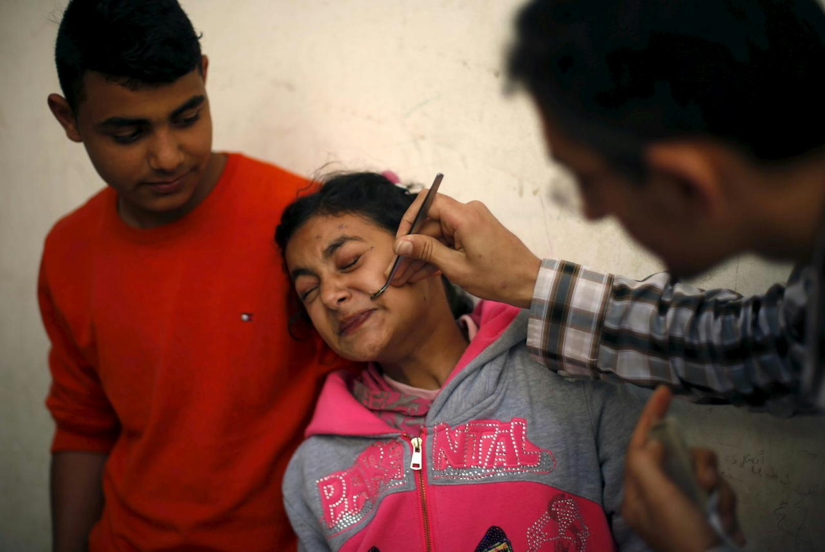 Im Bild: Eine junge Palästinenserin, die an Gesichtslähmung leidet, wird dagegen mit einer Biene gestochen.