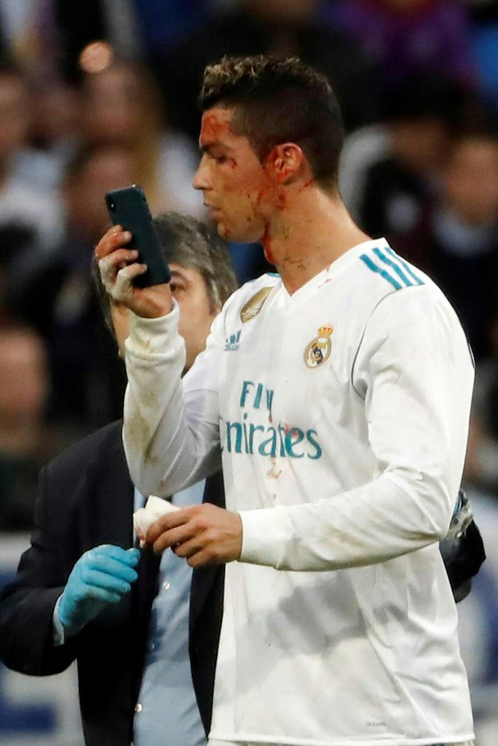 Ronaldo will es genau wissen, borgt sich das Handy vom Teamarzt aus und begutachtet die Verletzung.