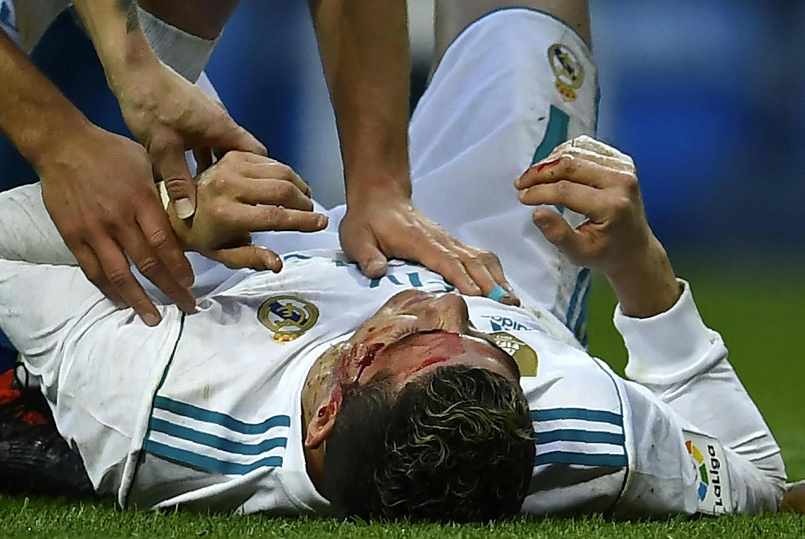 Cristiano Ronaldo blutend am Boden! Beim 7:1 gegen La Coruna verletzte sich der Real-Superstar übel am Kopf. Ein Gegenspieler traf ihn beim Kopfballtor zum 6:1 mit dem Schuh an der Stirn.