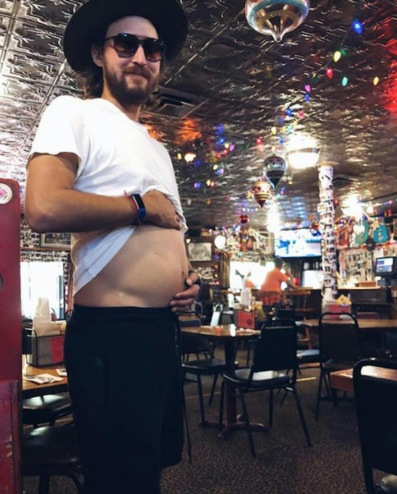 08.07.2018: Kate Hudson ist schwanger und ihr Herzblatt Chris Robinson "leidet" mit. "Gemeinsam schwanger", ist Kate amüsiert