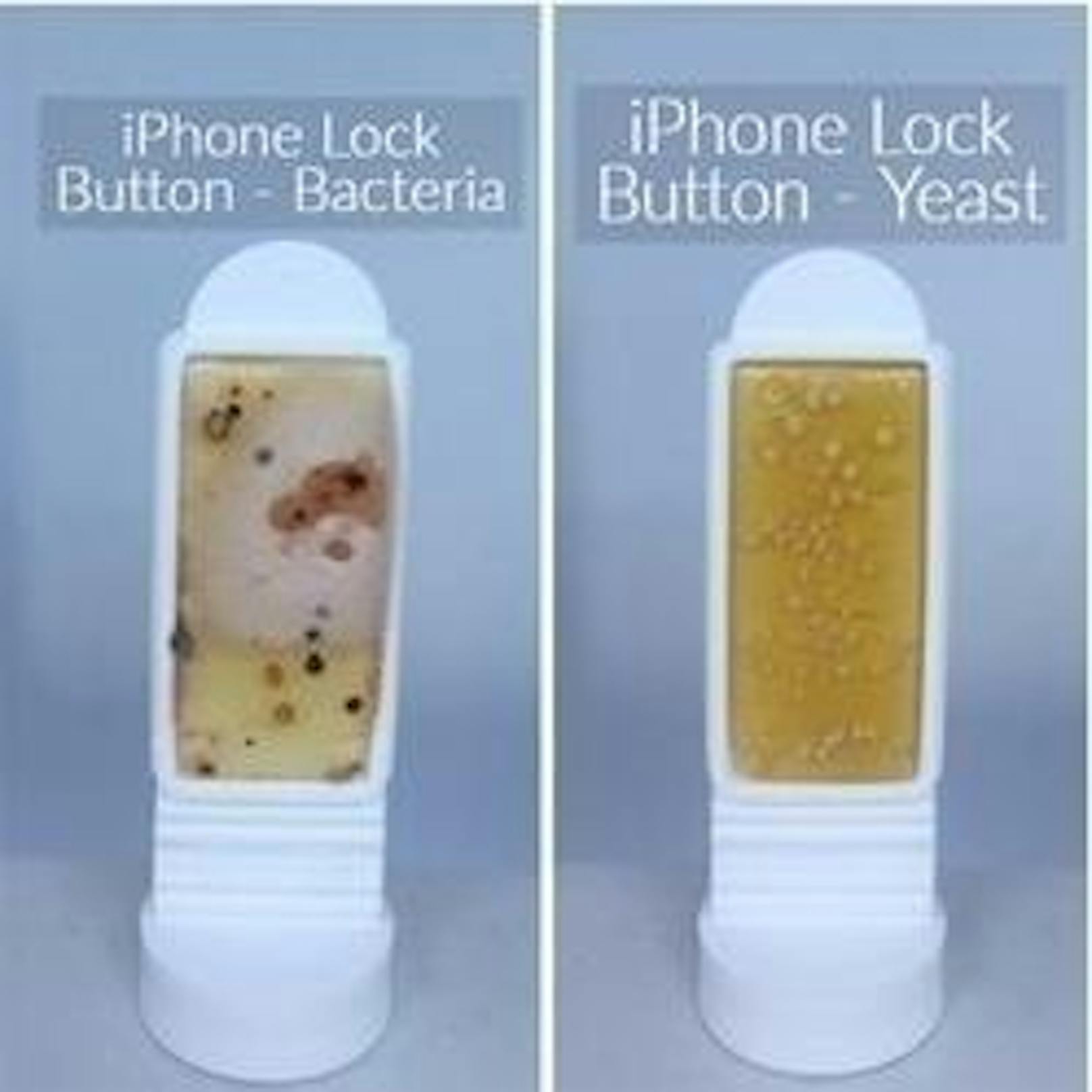 Der Sperr-Button am iPhone, einmal die Bakterien-Auswertung (l.) und einmal die Hefepilz-Auswertung