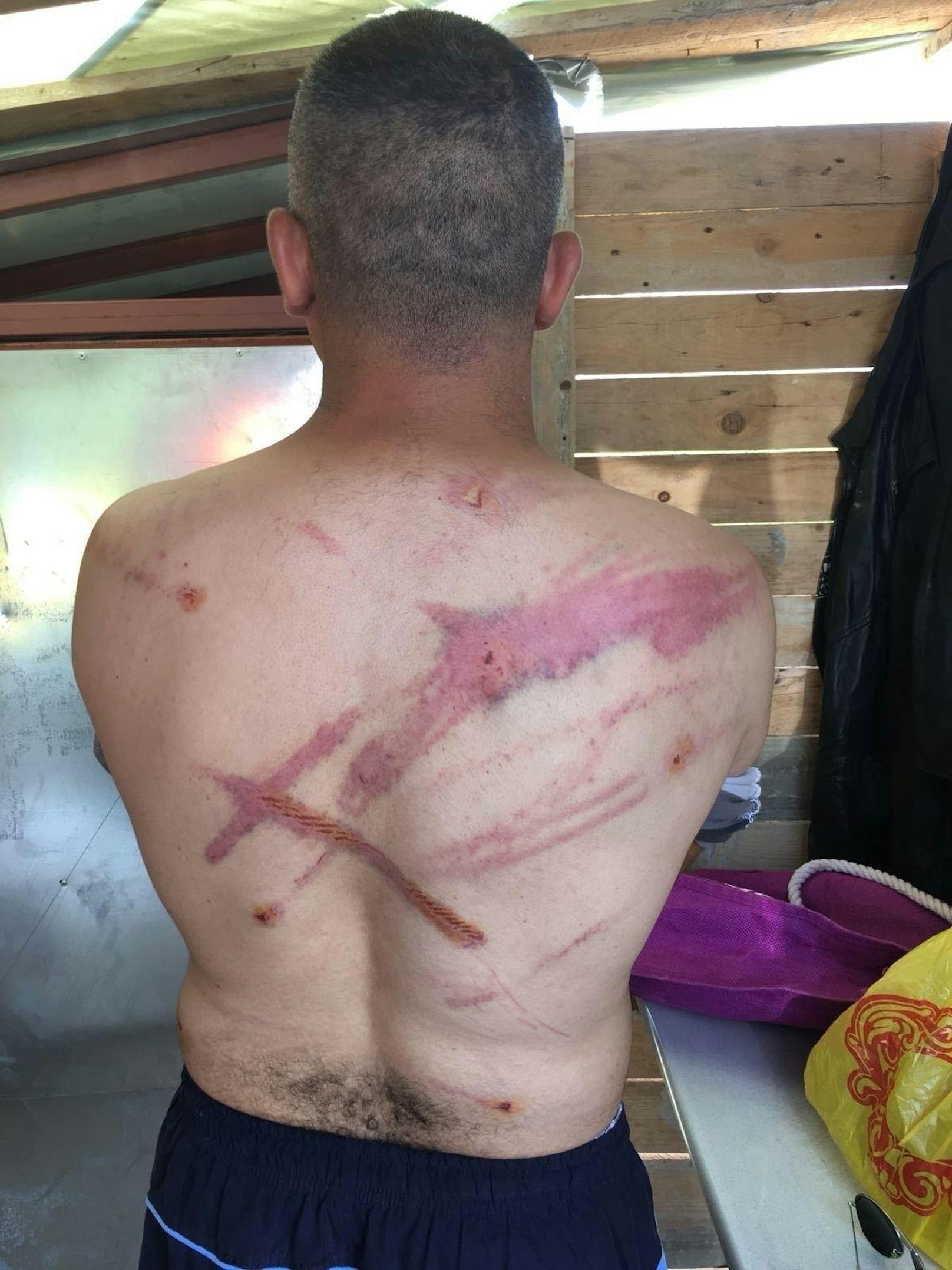 Der Algerier wandte sich mit seinen Verletzungen an eine Freiwilligen-Gruppe in Bosnien.