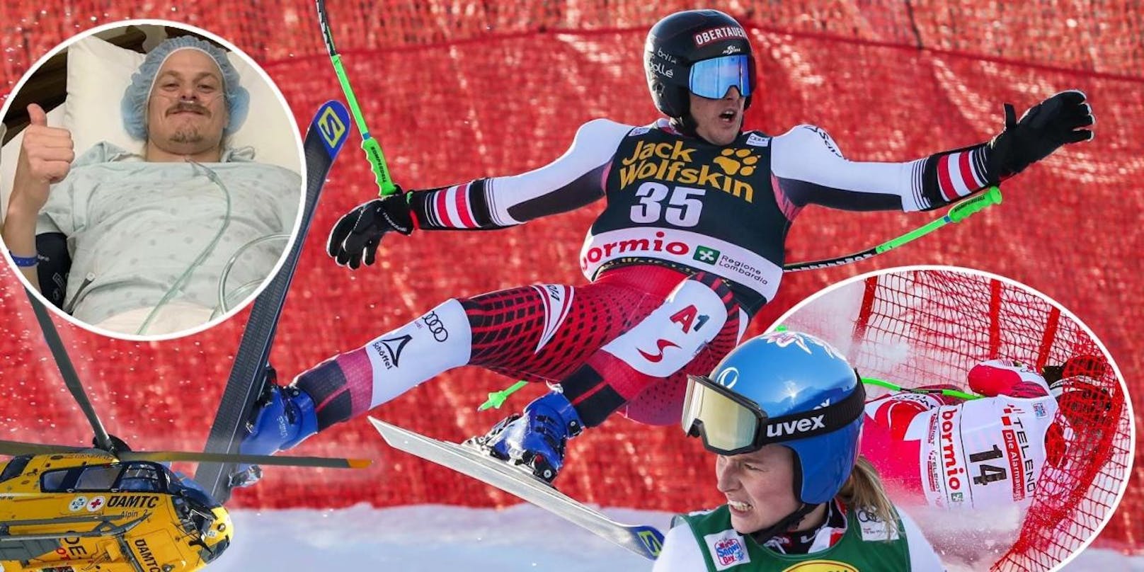 Die Verletzten-Liste in der Ski-Saison 2019/20 ist lang. Hannes Reichelt, Bernadette Schild und Manuel Feller sind nur drei von vielen ÖSV-Patienten, die vorübergehend oder sogar den ganzen Winter pausieren mussten. <em>"Heute"</em> hat die Übersicht.