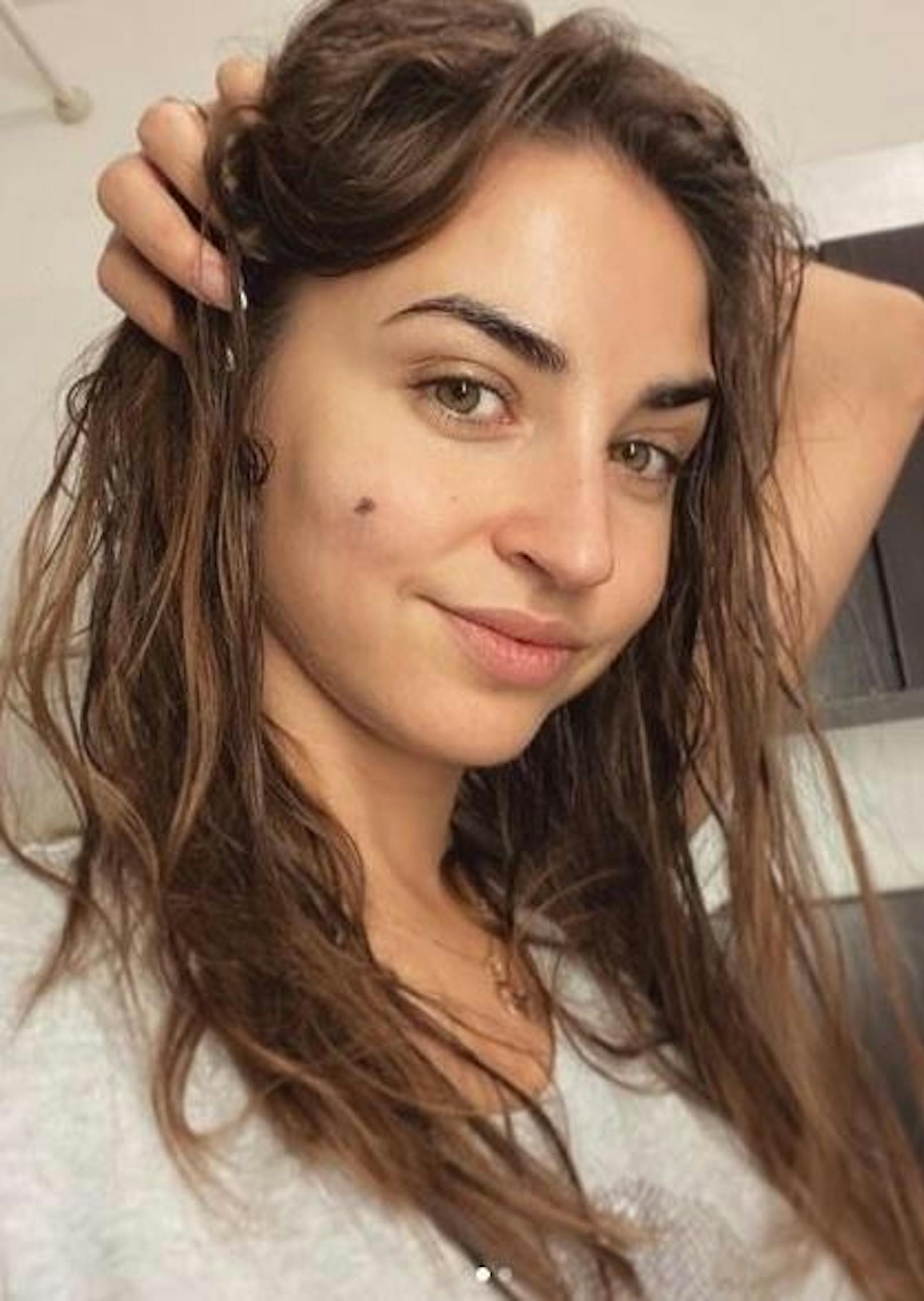 09.11.2019: Die aus der RTL-Sendung "Let's Dance" bekannte Profitänzerin Ekaterina Leonova (32) musste sich Teile ihres Muttermals im Gesicht entfernen lassen, wie sie auf Instagram mitteilte. 