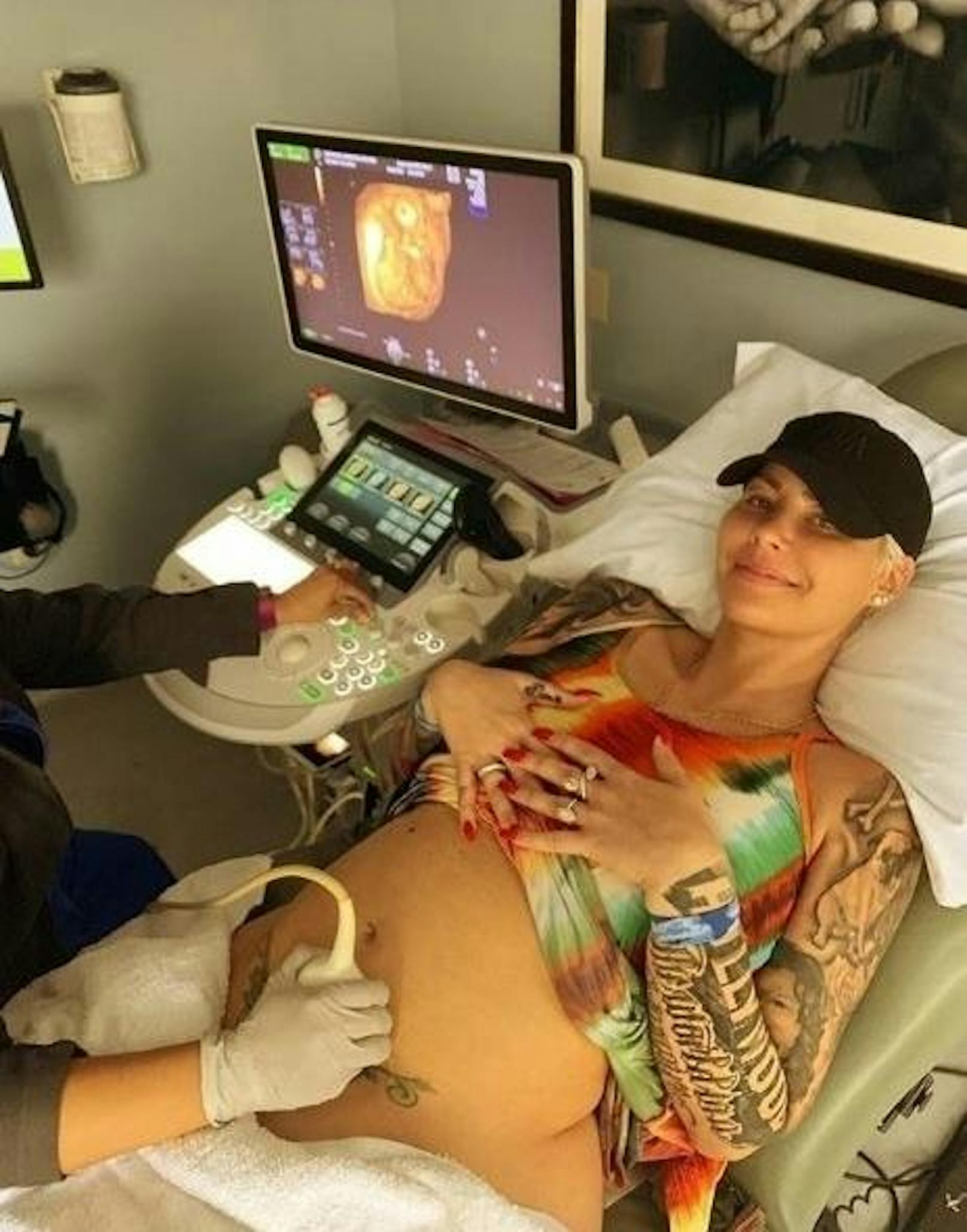 04.04.2019: Amber Rose erwartet ihr zweites Kind. Auf Instagram ließ die 35-Jährige ihre Fans mit einem Ultraschallfoto wissen, dass ihr Sohn Sebastian bald ein großer Bruder sein wird.