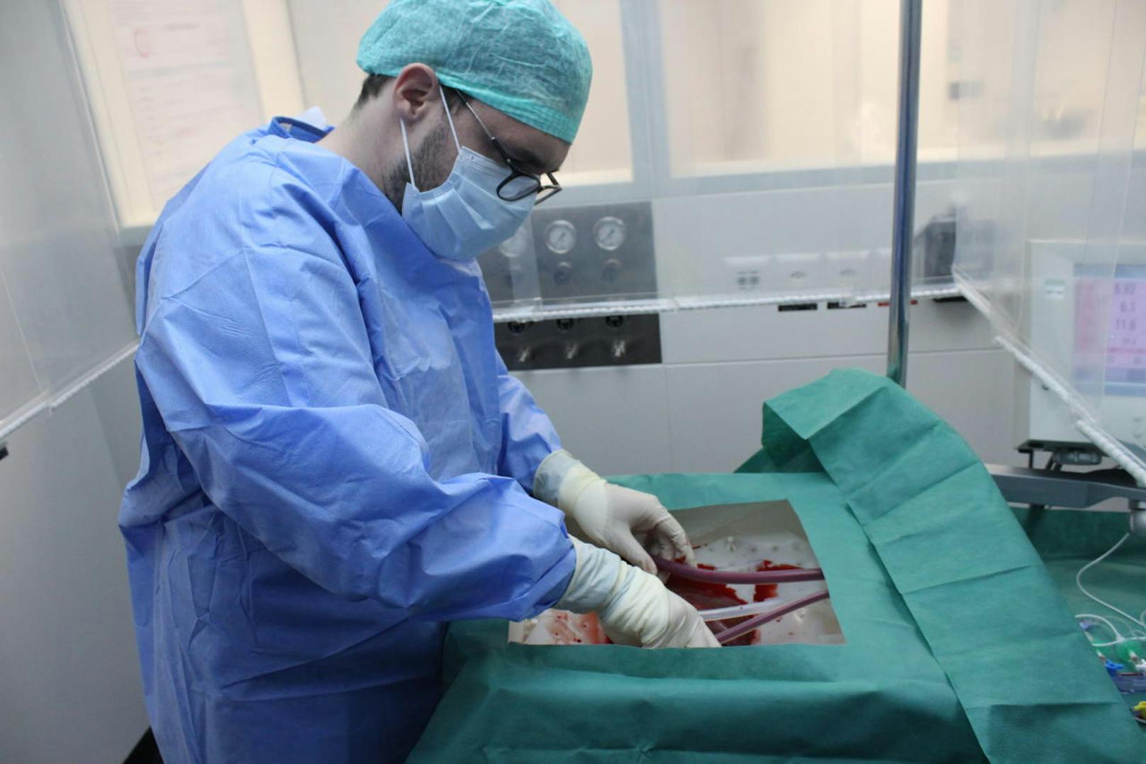 Ein Chirurg schließt die Spenderleber an die Maschine an.