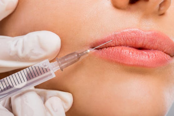 Bei dem Covid-19-Wirkstoff des Herstellers Moderna wurden Nebenwirkungen für Patienten mit Face Fillern gemeldet.