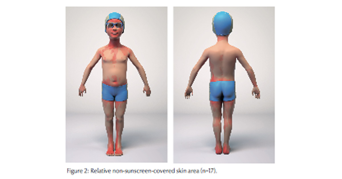 Forschungen von Beiersdorf haben gezeigt: Es werden auch beim Eincremen von Kindern immer wieder bestimmte Körperareale vergessen.