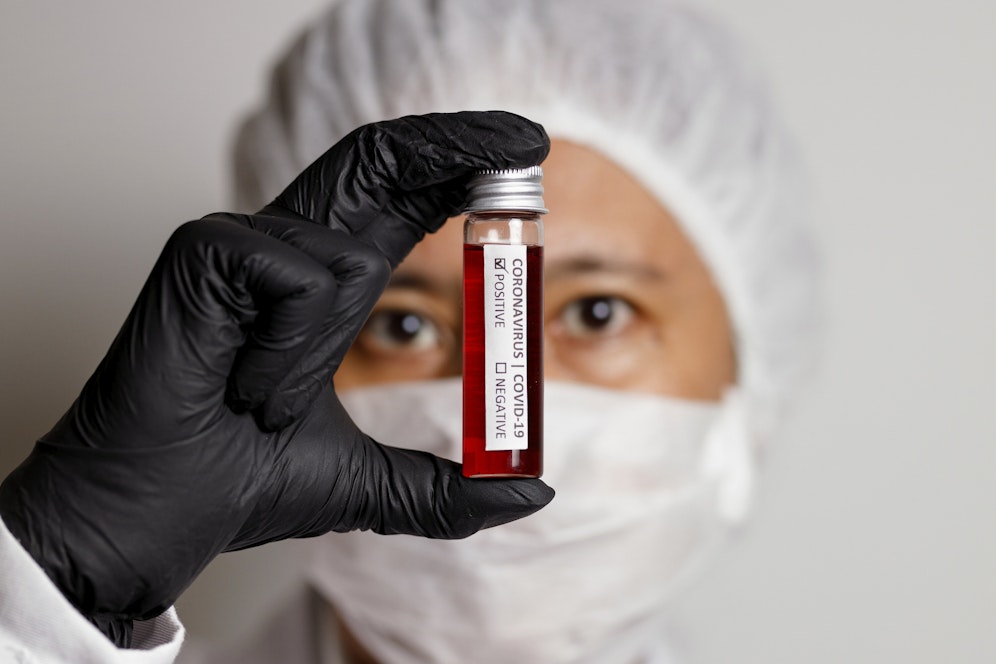 Die WHO warnt vor der Gefahr einer zweiten Welle.